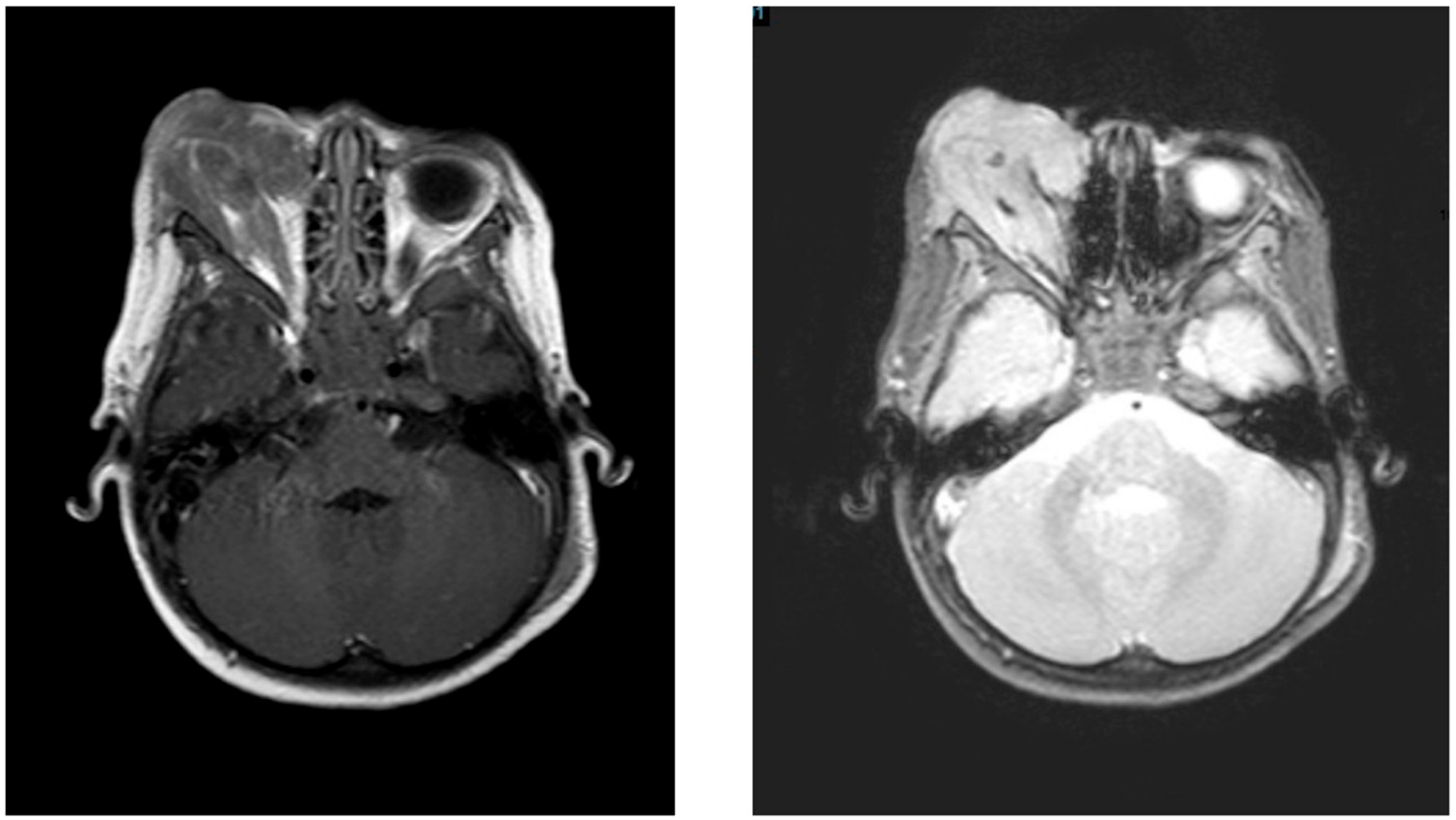 Children 04 00113 g001 550