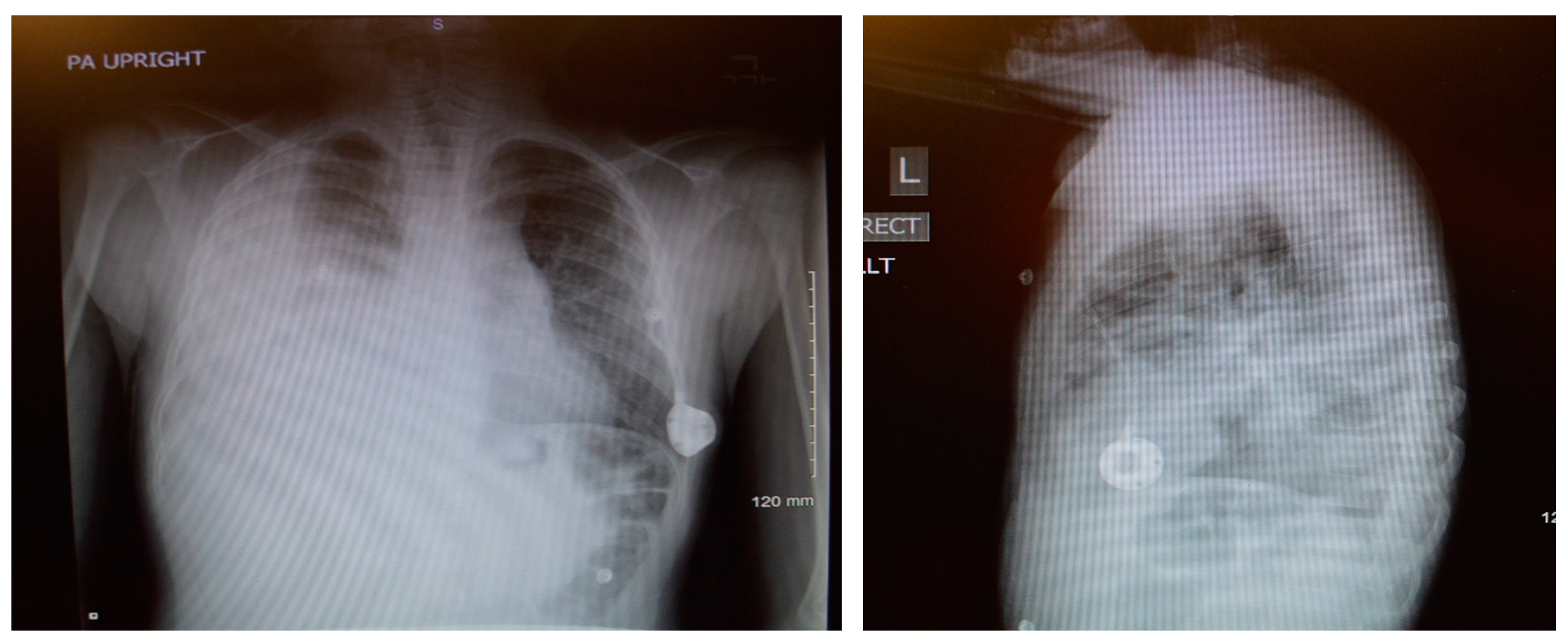 Children 05 00007 g001 550