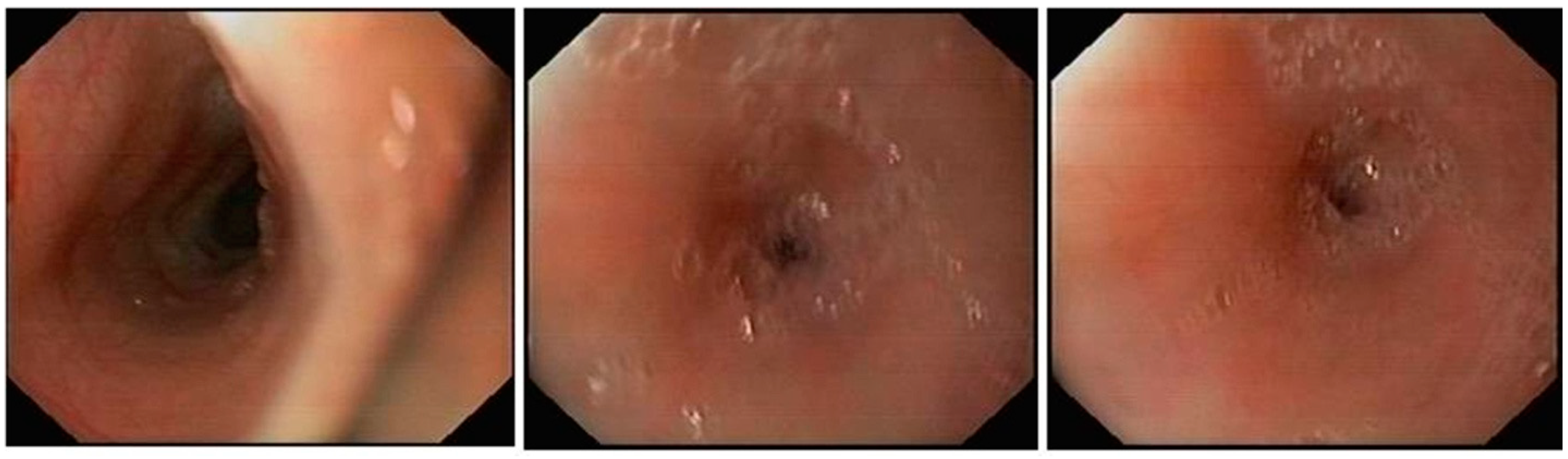 Children 05 00010 g003 550