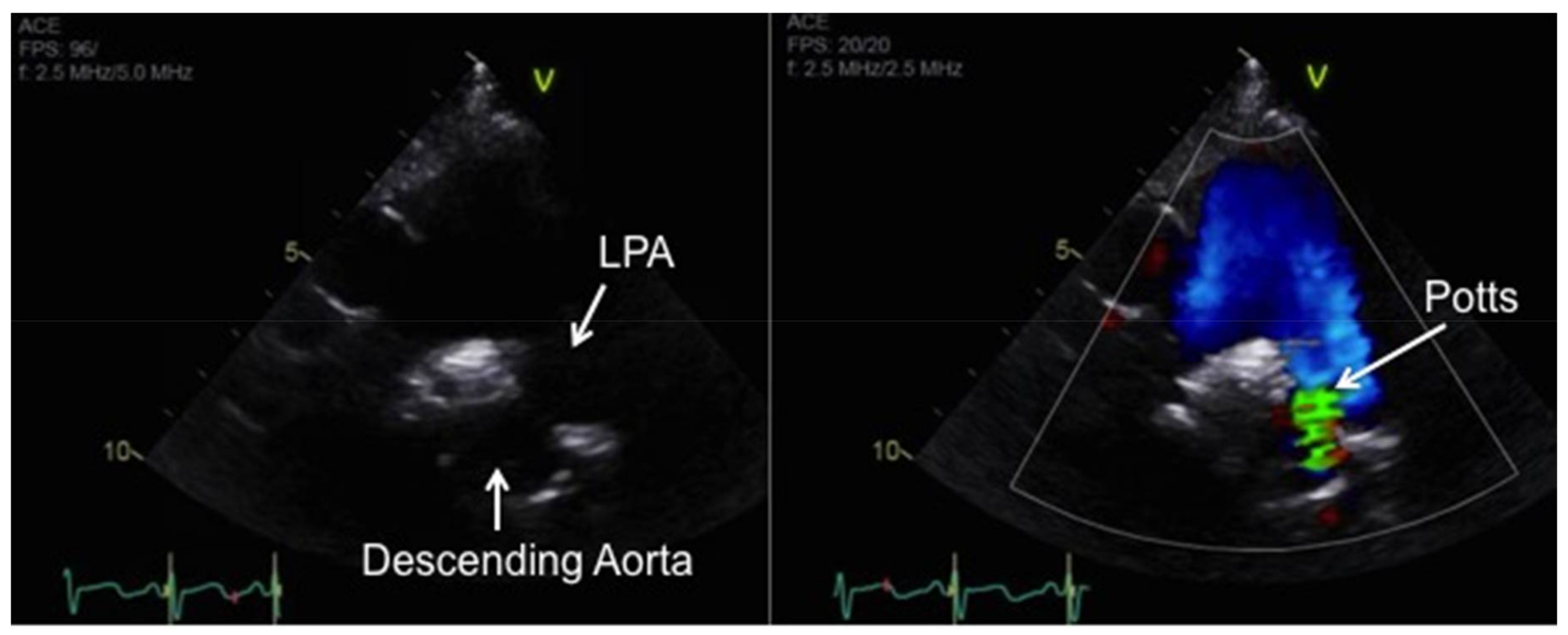 Children 05 00044 g016 Children 05 00044 g016