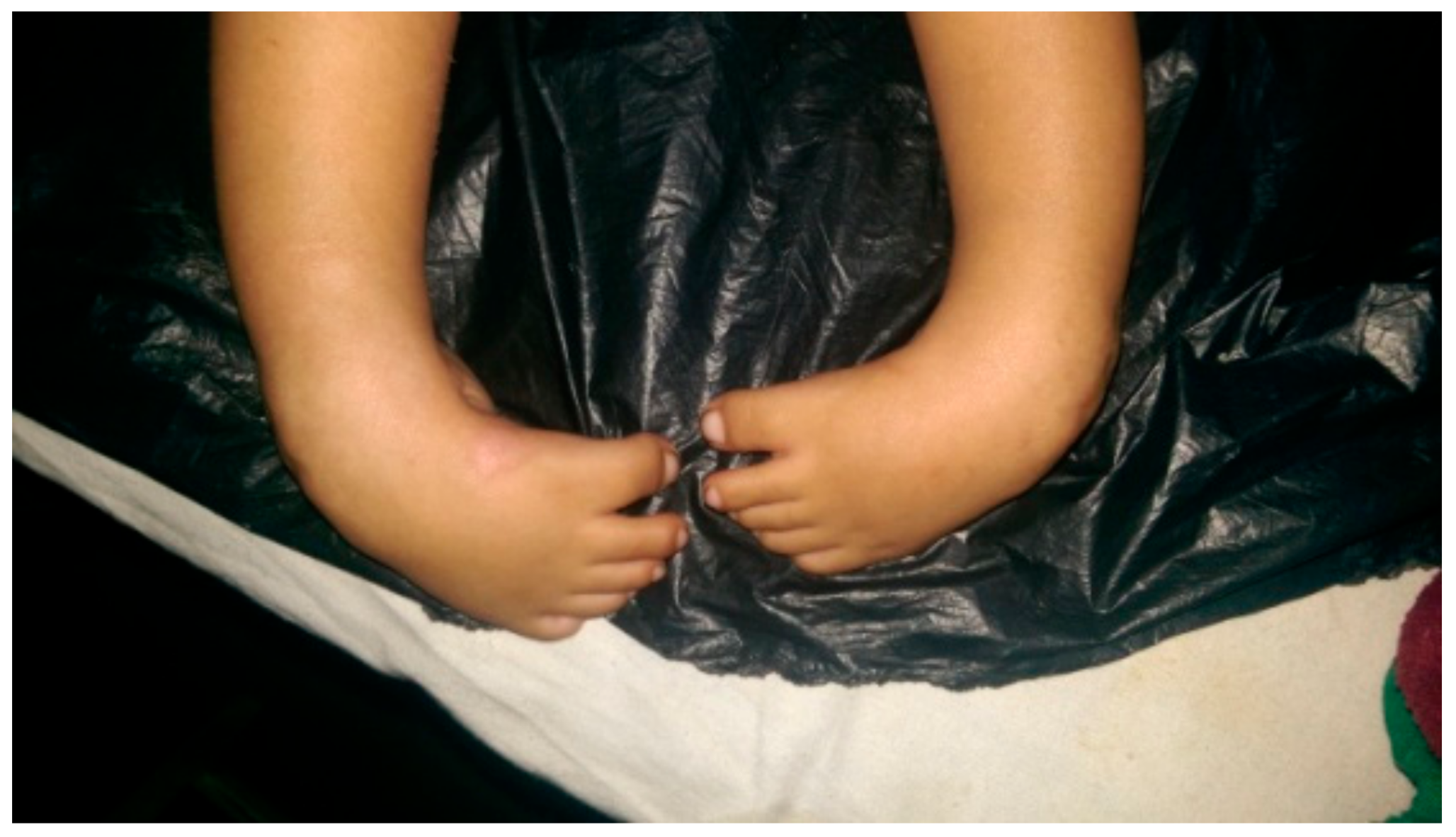 Children 05 00049 g001