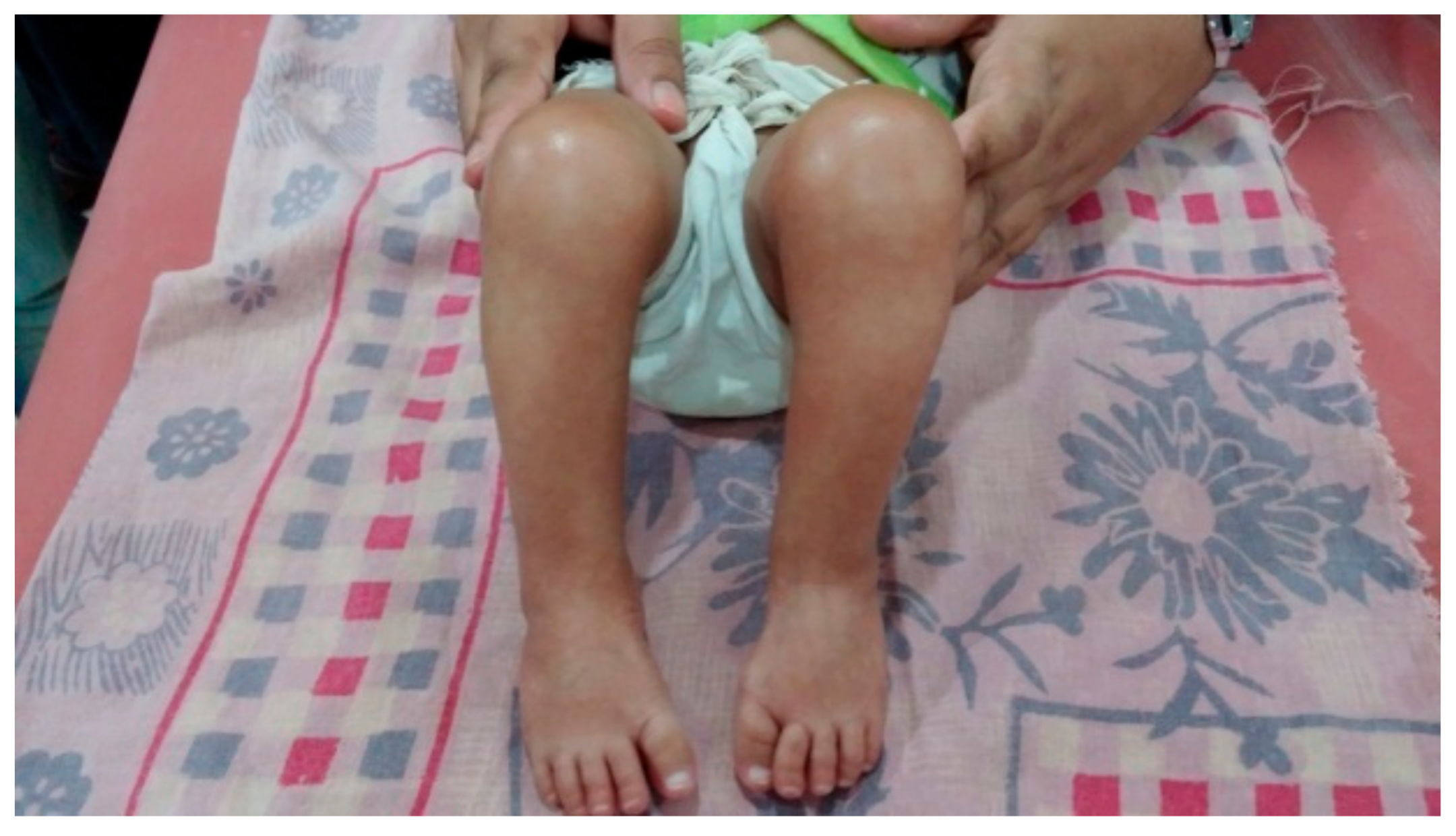 Children 05 00049 g005