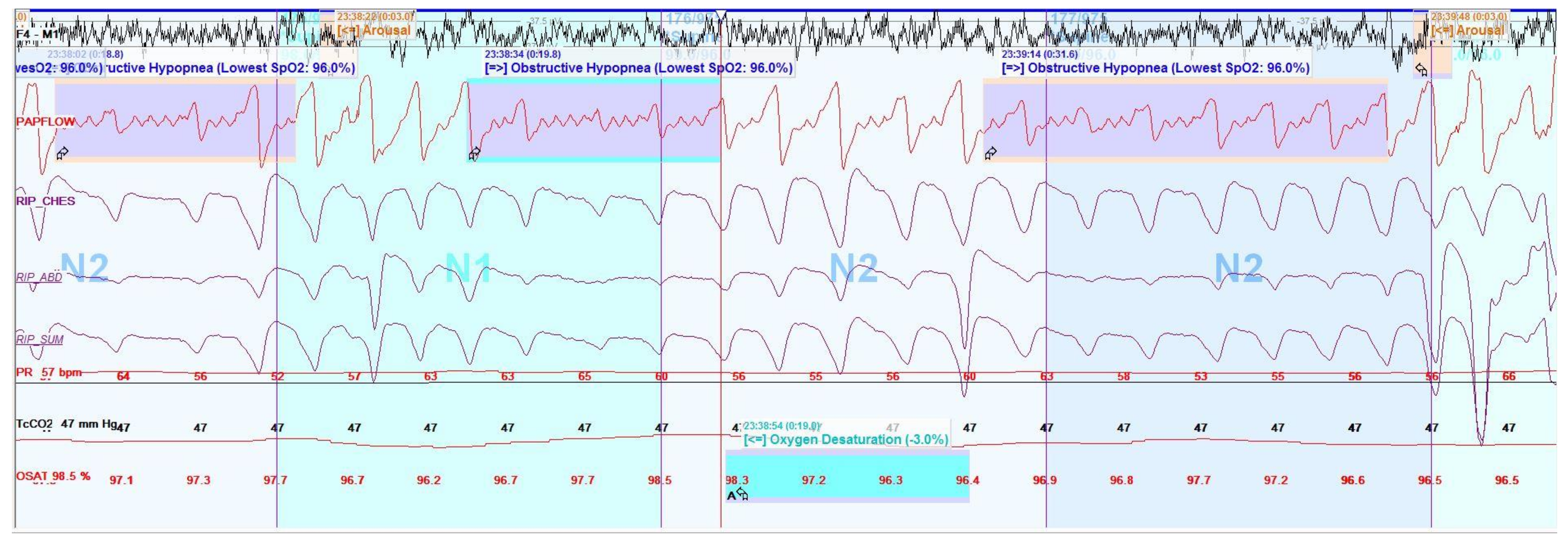 Children 05 00078 g008 Children 05 00078 g008