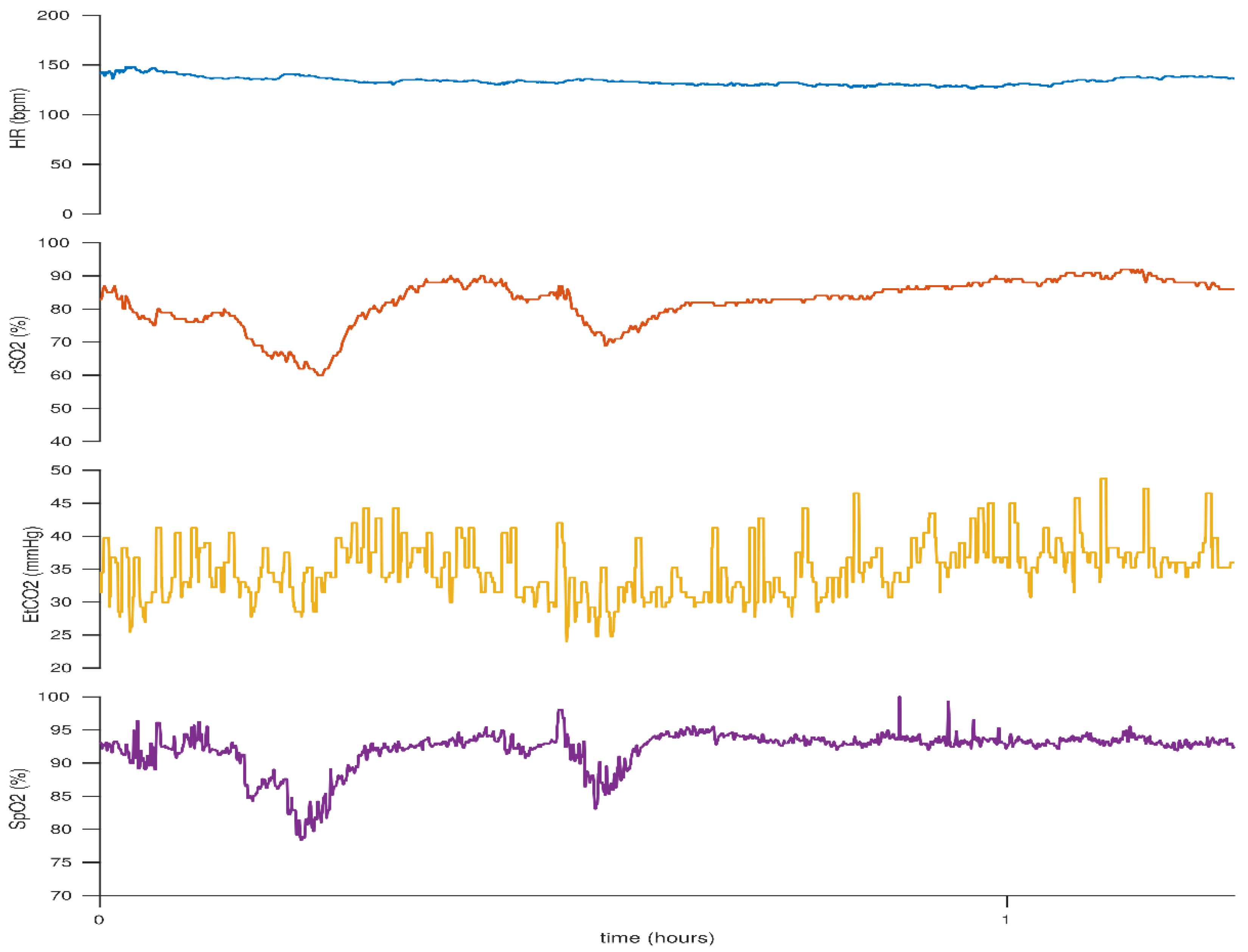 Children 05 00094 g007 Children 05 00094 g007