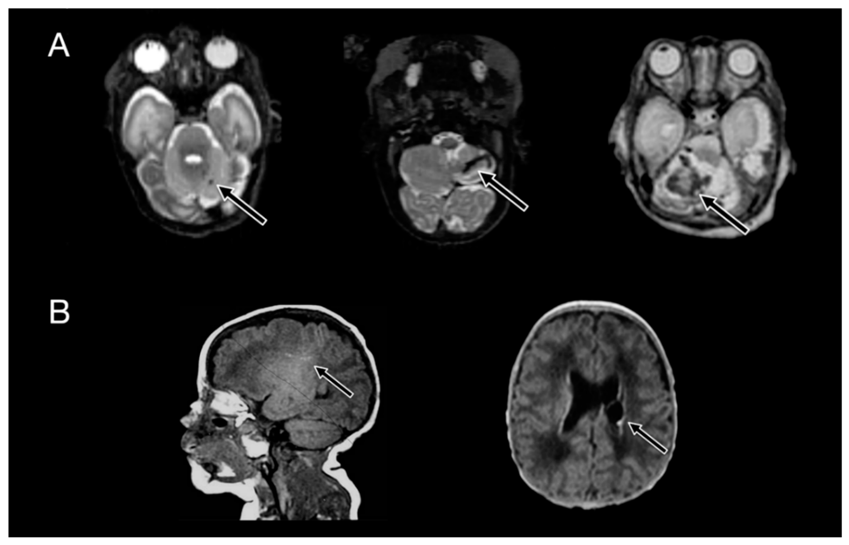 Children 05 00151 g002