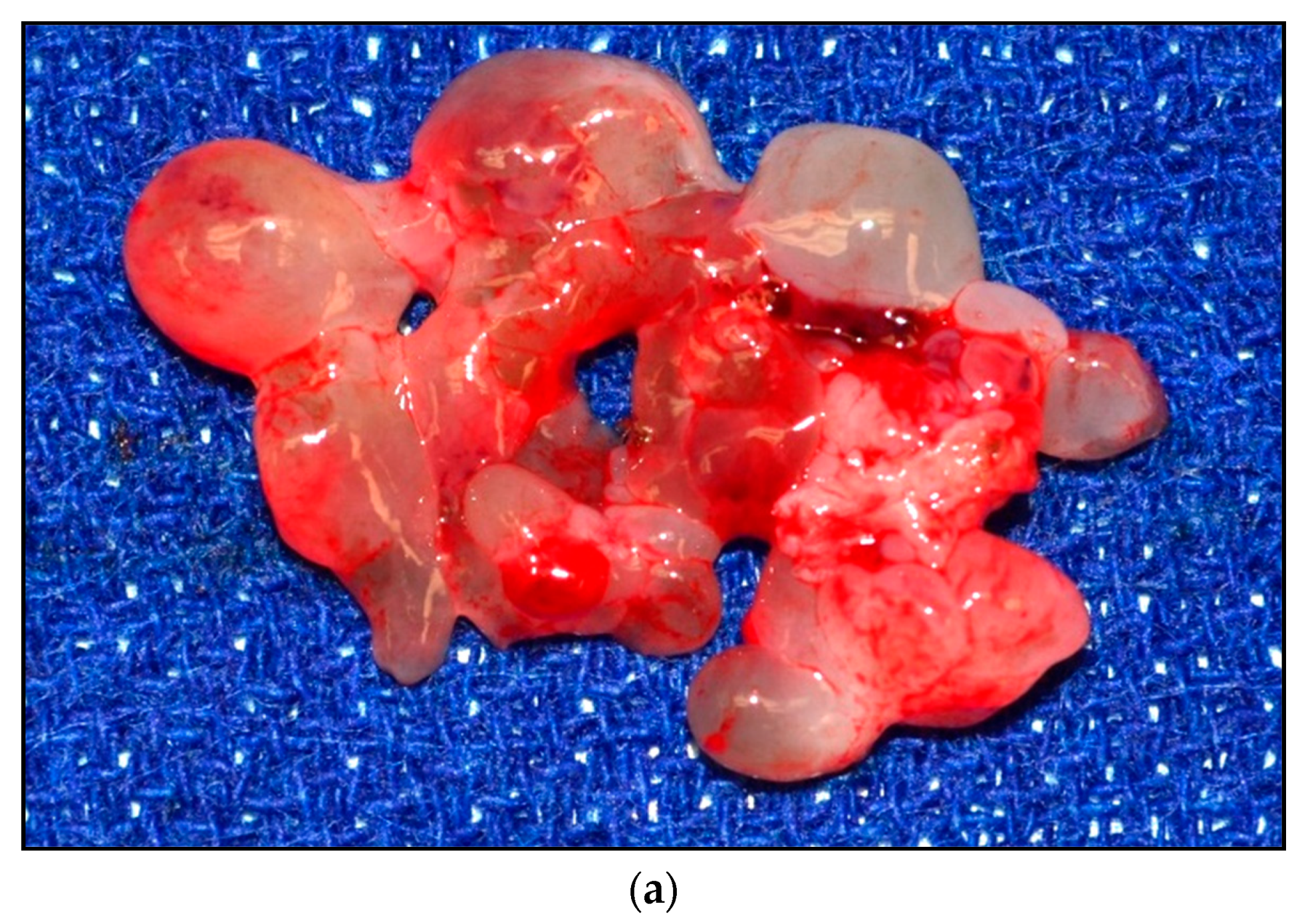 Children 05 00165 g001a Children 05 00165 g001a