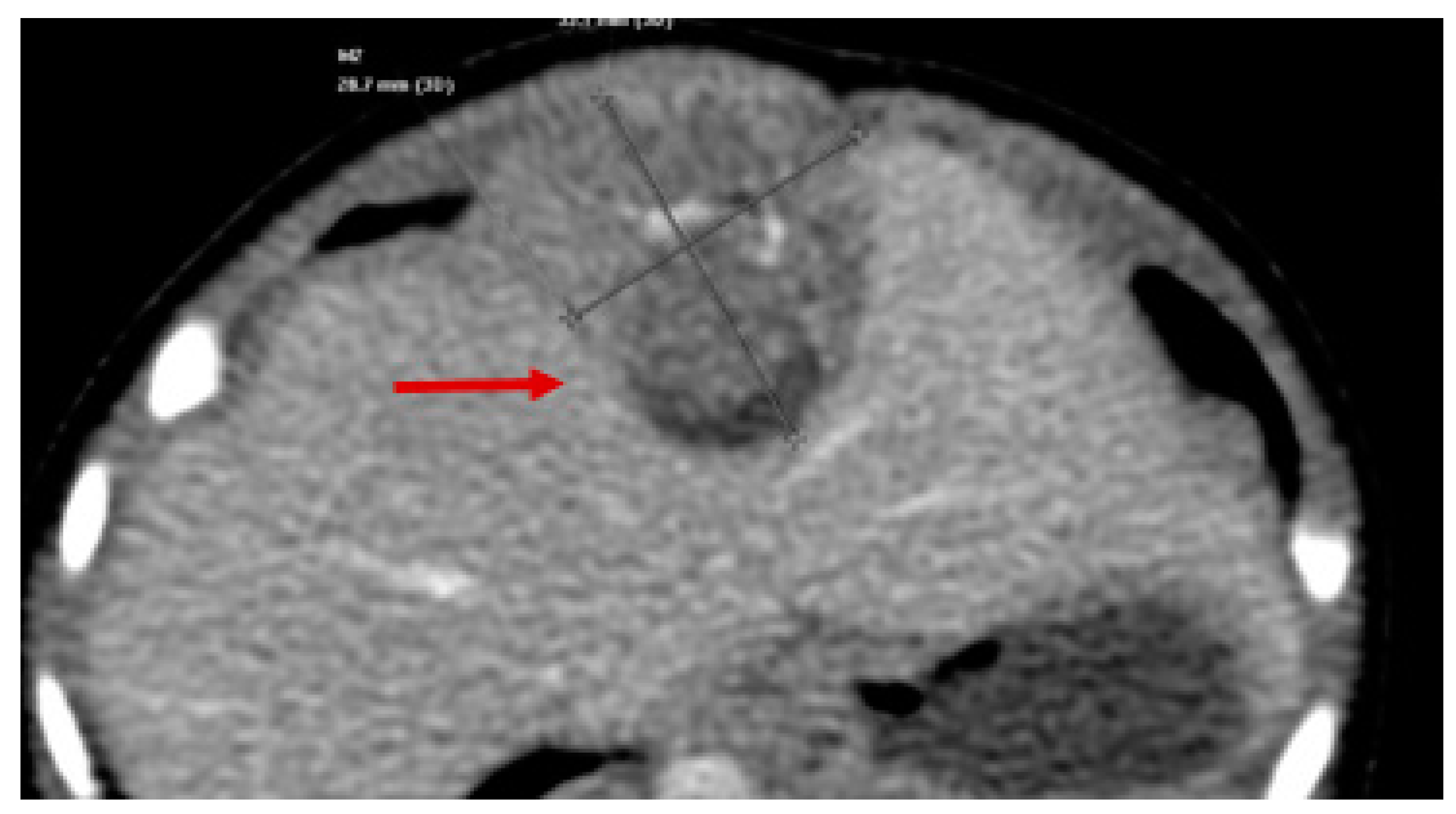 Children 05 00165 g003 Children 05 00165 g003