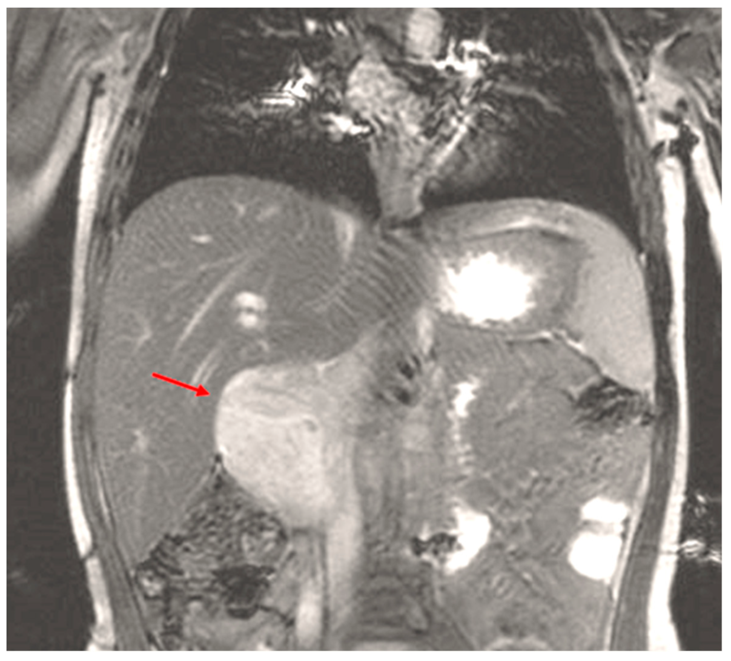 Children 05 00165 g004 Children 05 00165 g004