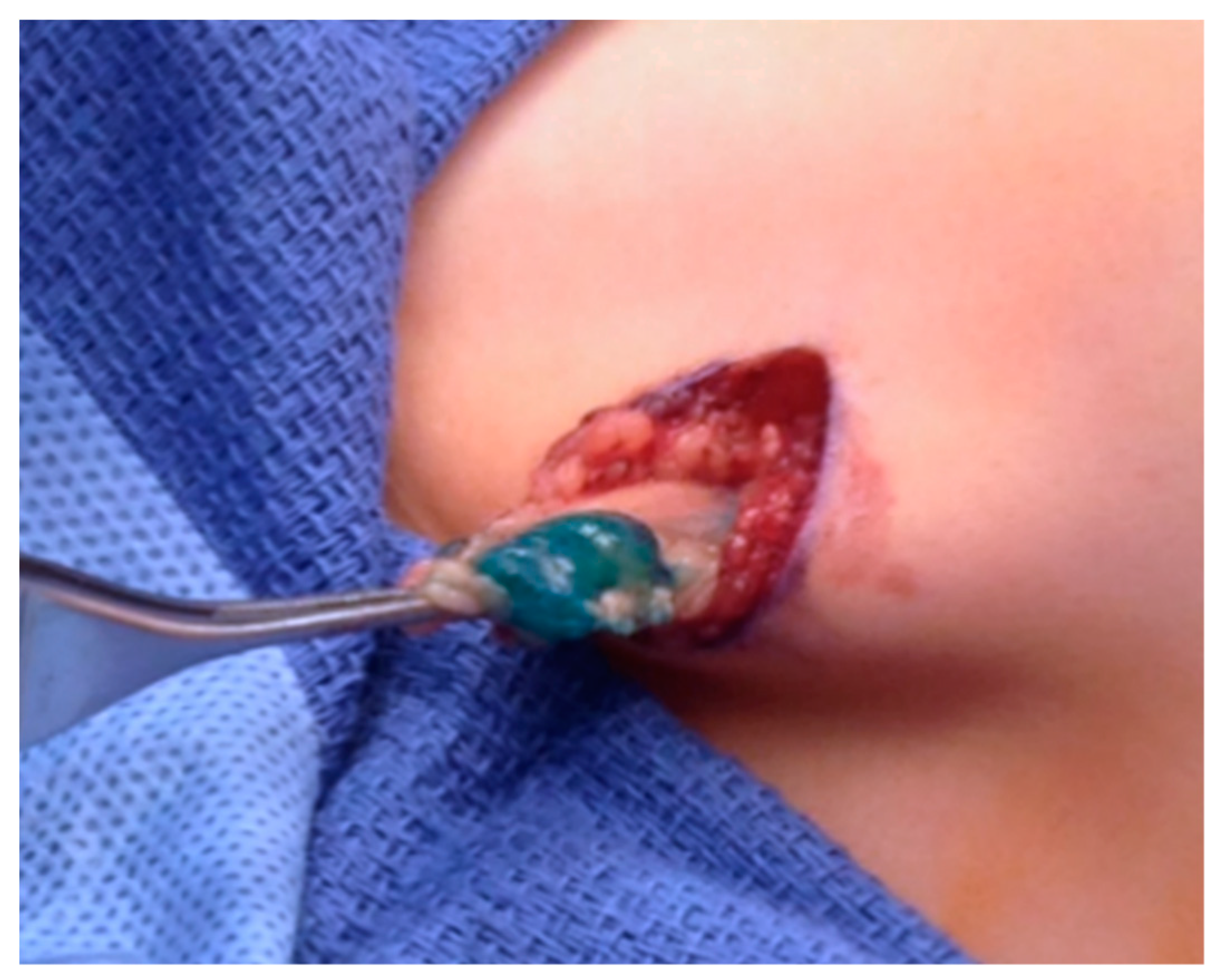 Children 05 00165 g005 Children 05 00165 g005