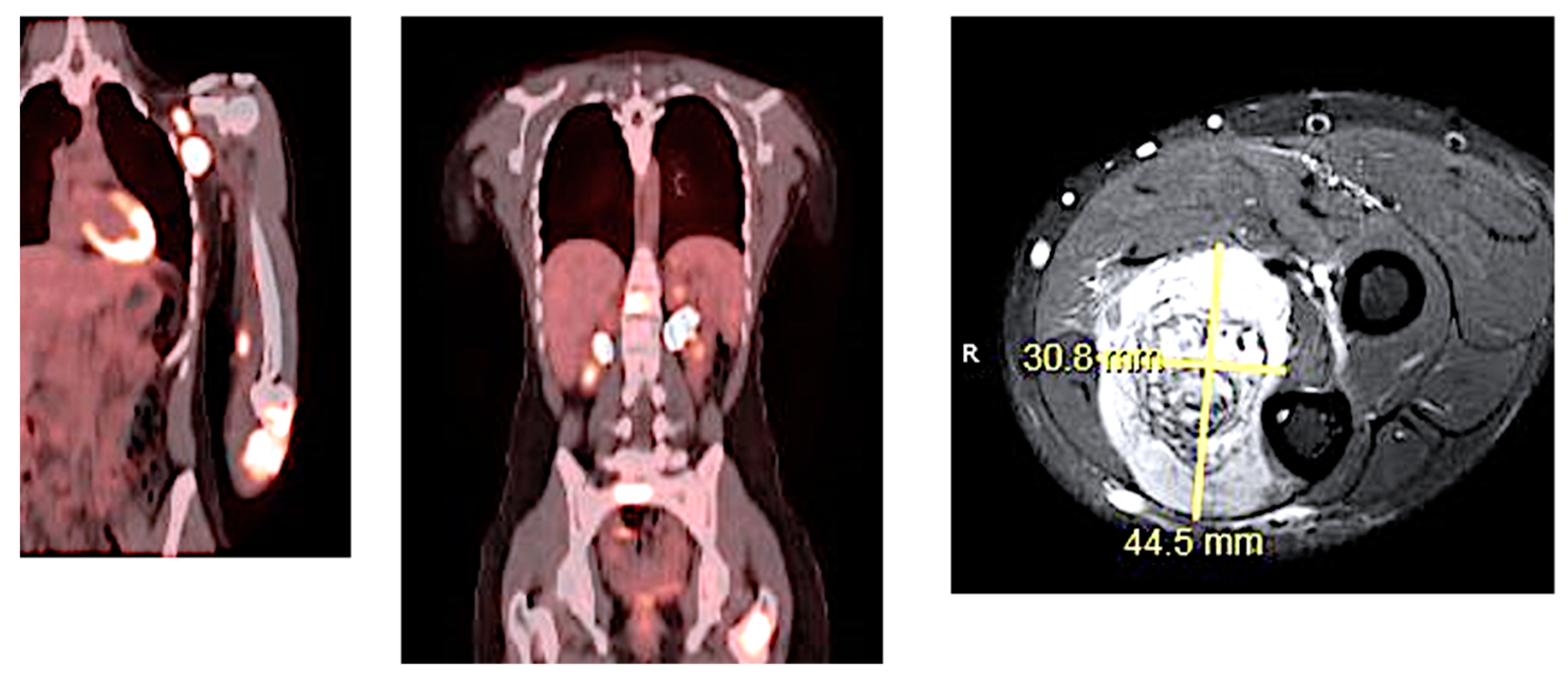 Children 05 00165 g006 Children 05 00165 g006