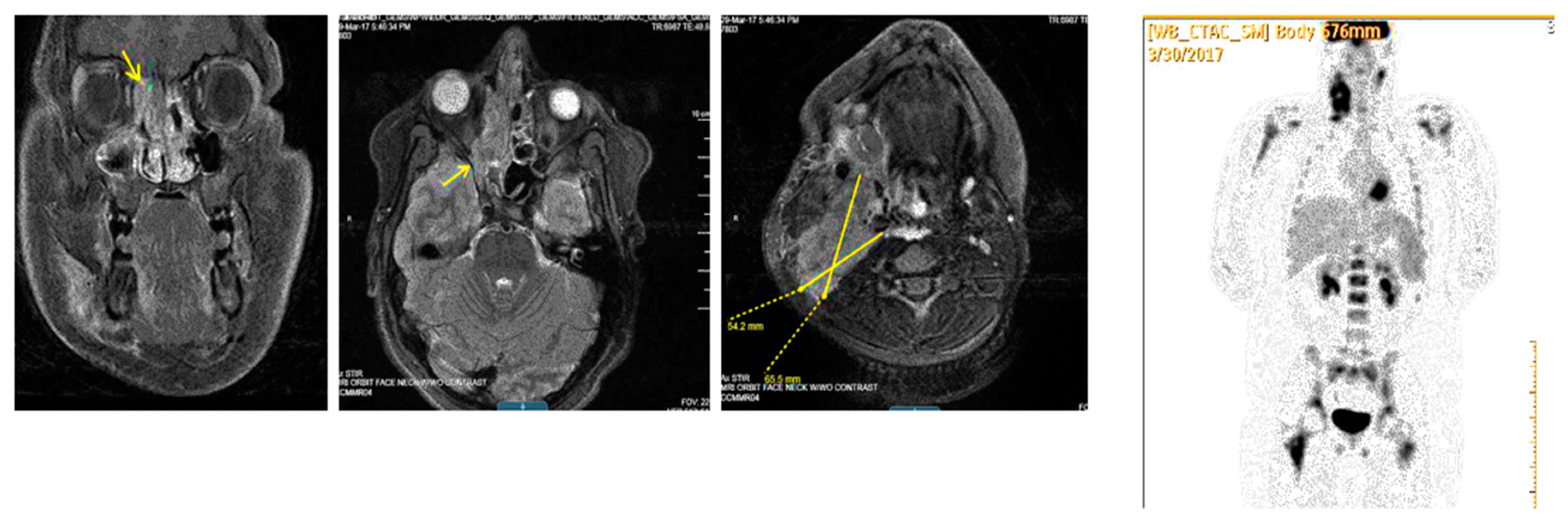 Children 05 00165 g007 Children 05 00165 g007