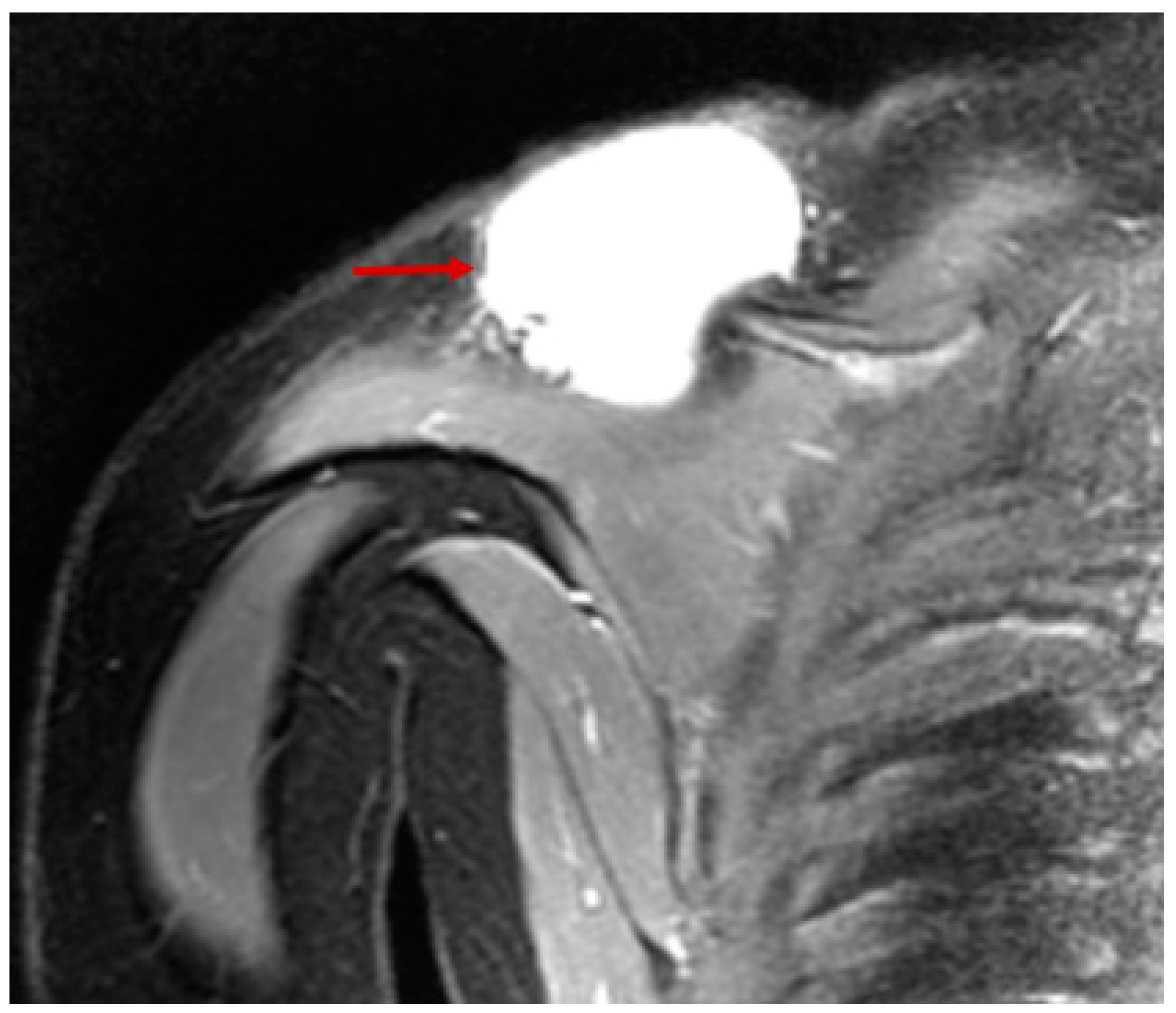 Children 05 00165 g009 Children 05 00165 g009