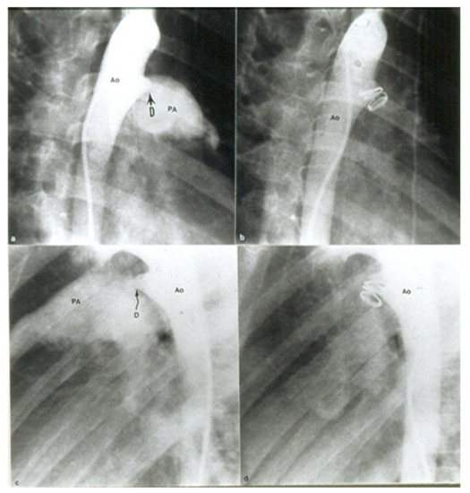 健康・医学 Surgery for congenital heart defects Surgery for Congenital Heart Defects: Stark, J., De Leval, M