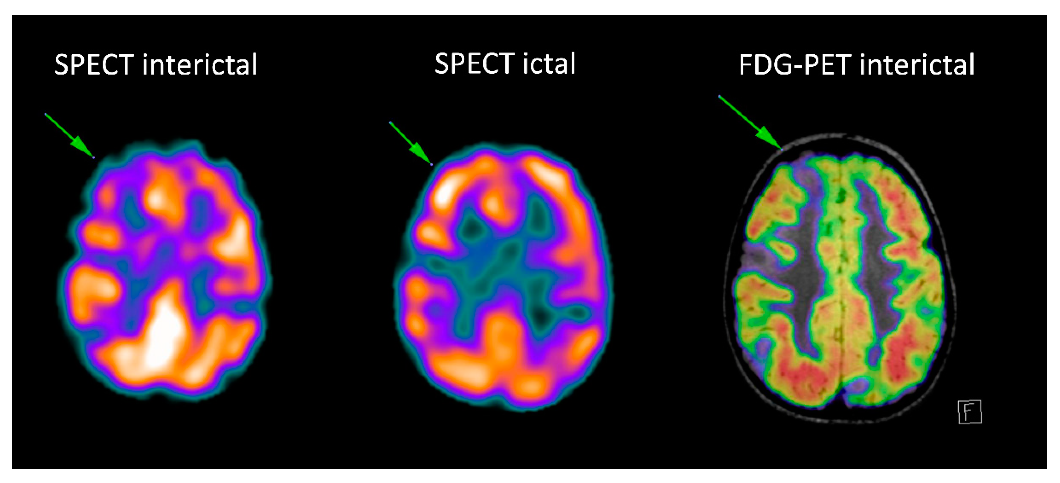 Children 06 00043 g003 Children 06 00043 g003