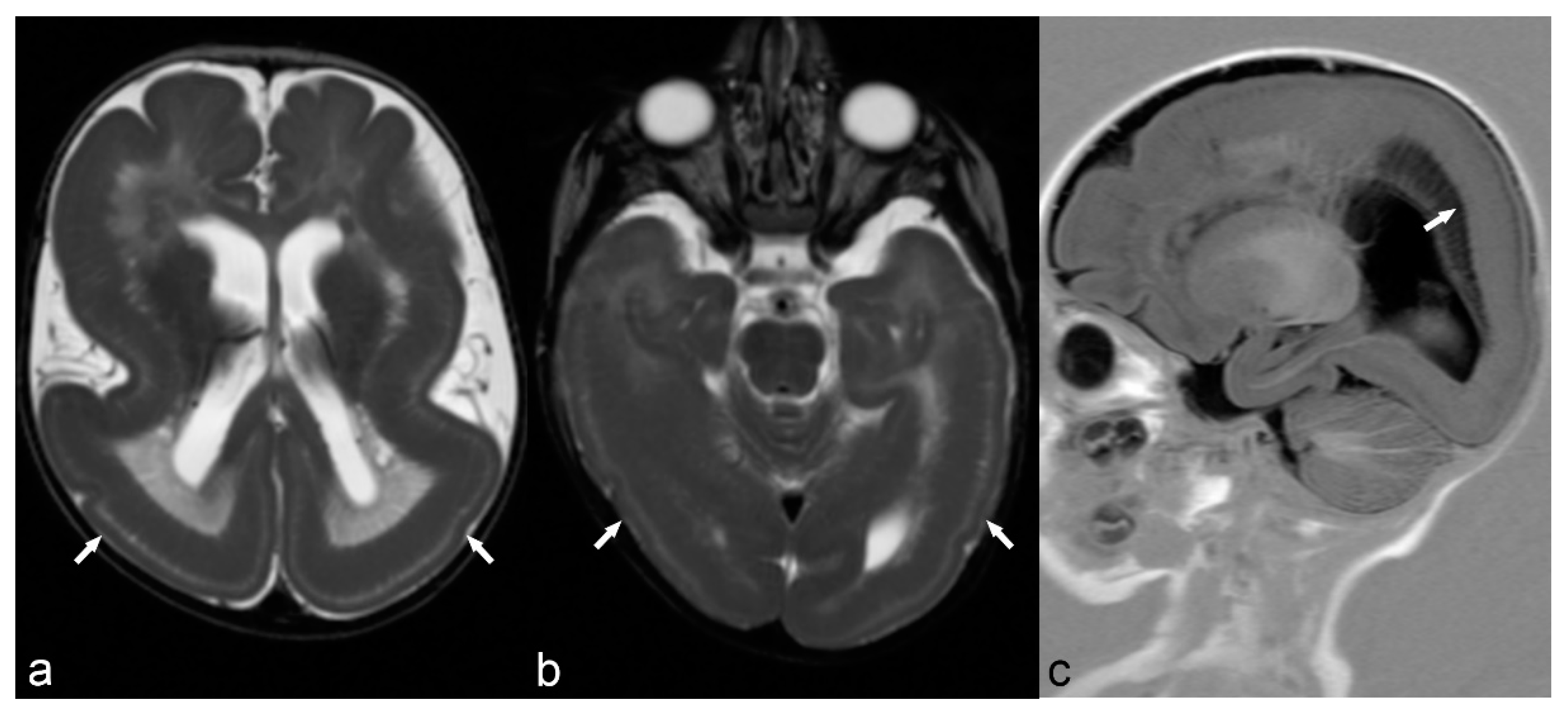 Children 06 00043 g006 Children 06 00043 g006