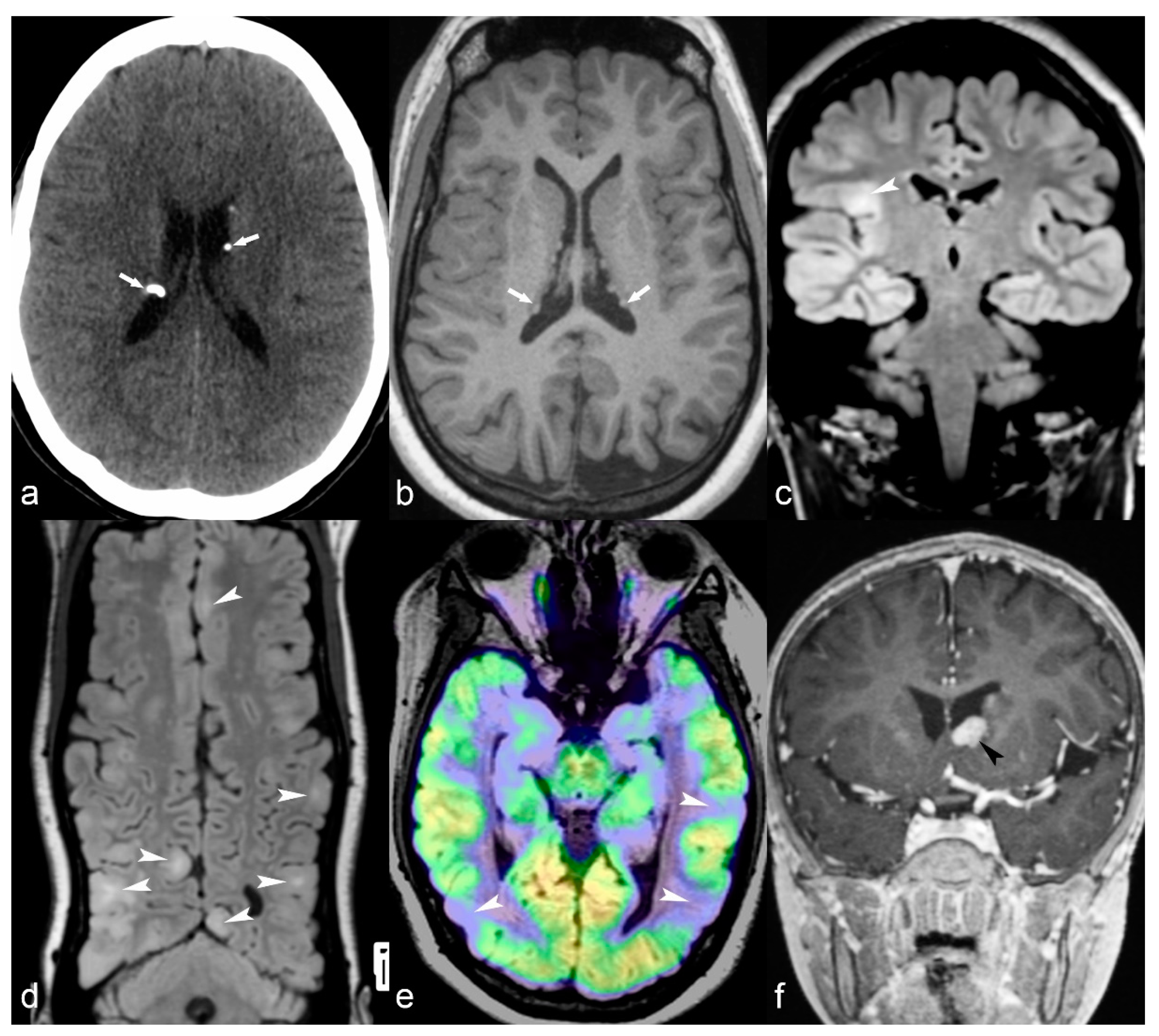 Children 06 00043 g007 Children 06 00043 g007