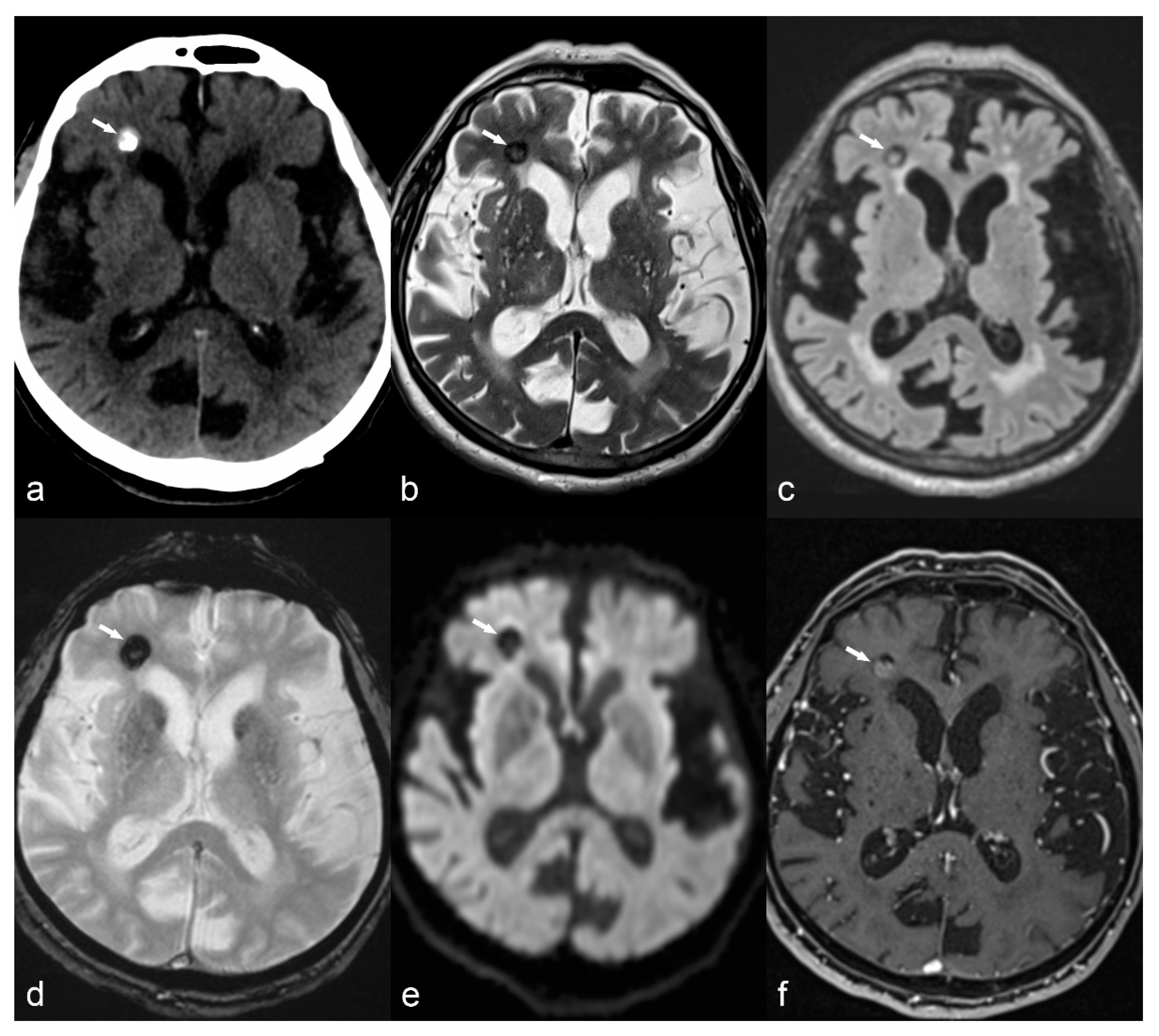 Children 06 00043 g009 Children 06 00043 g009