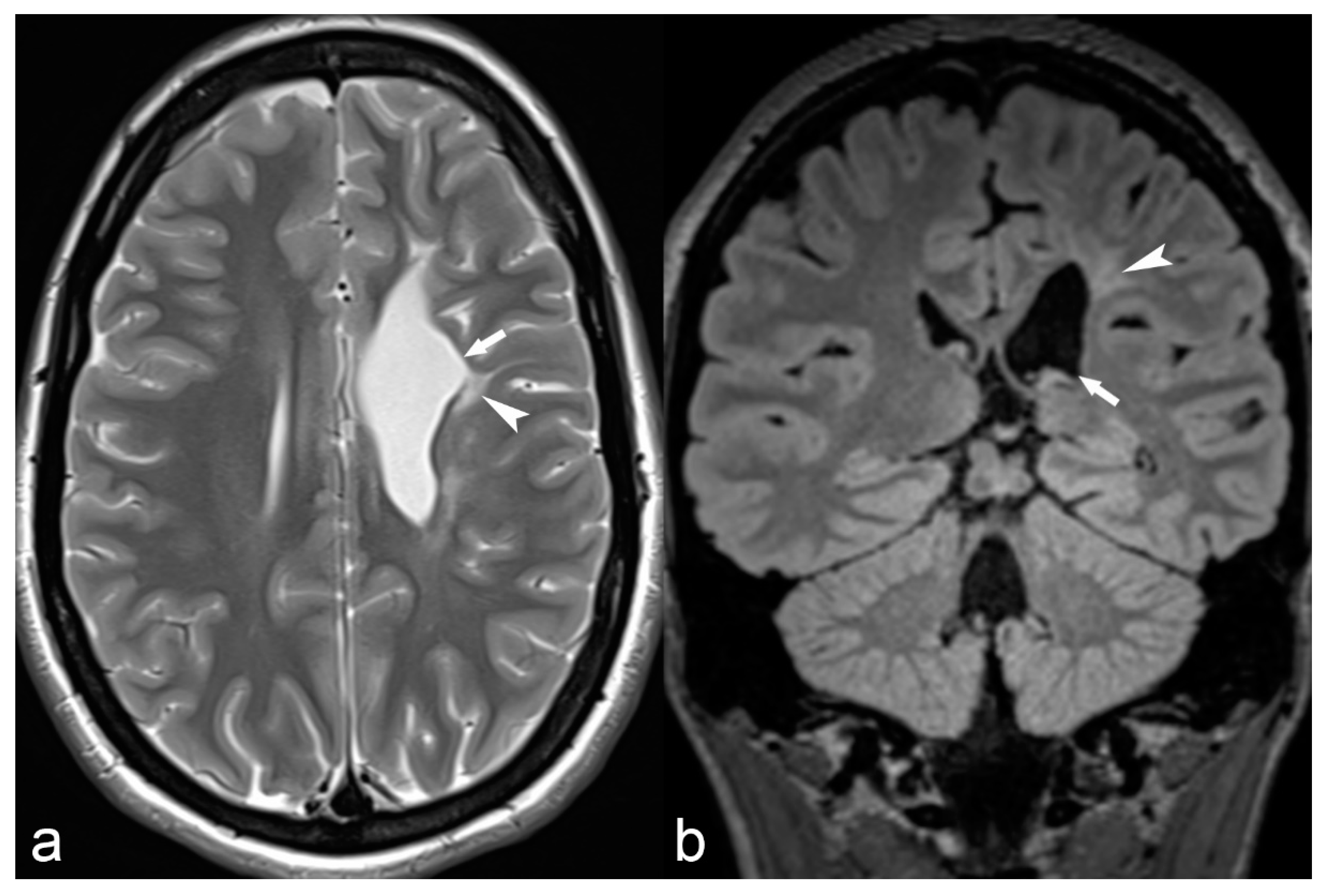 Children 06 00043 g010 Children 06 00043 g010