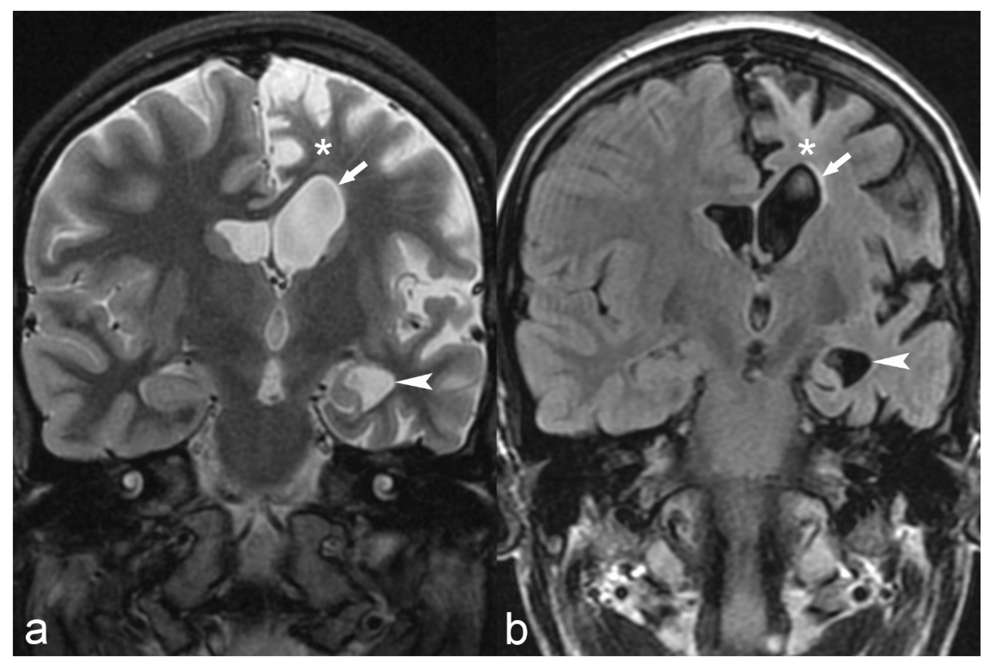 Children 06 00043 g012 Children 06 00043 g012