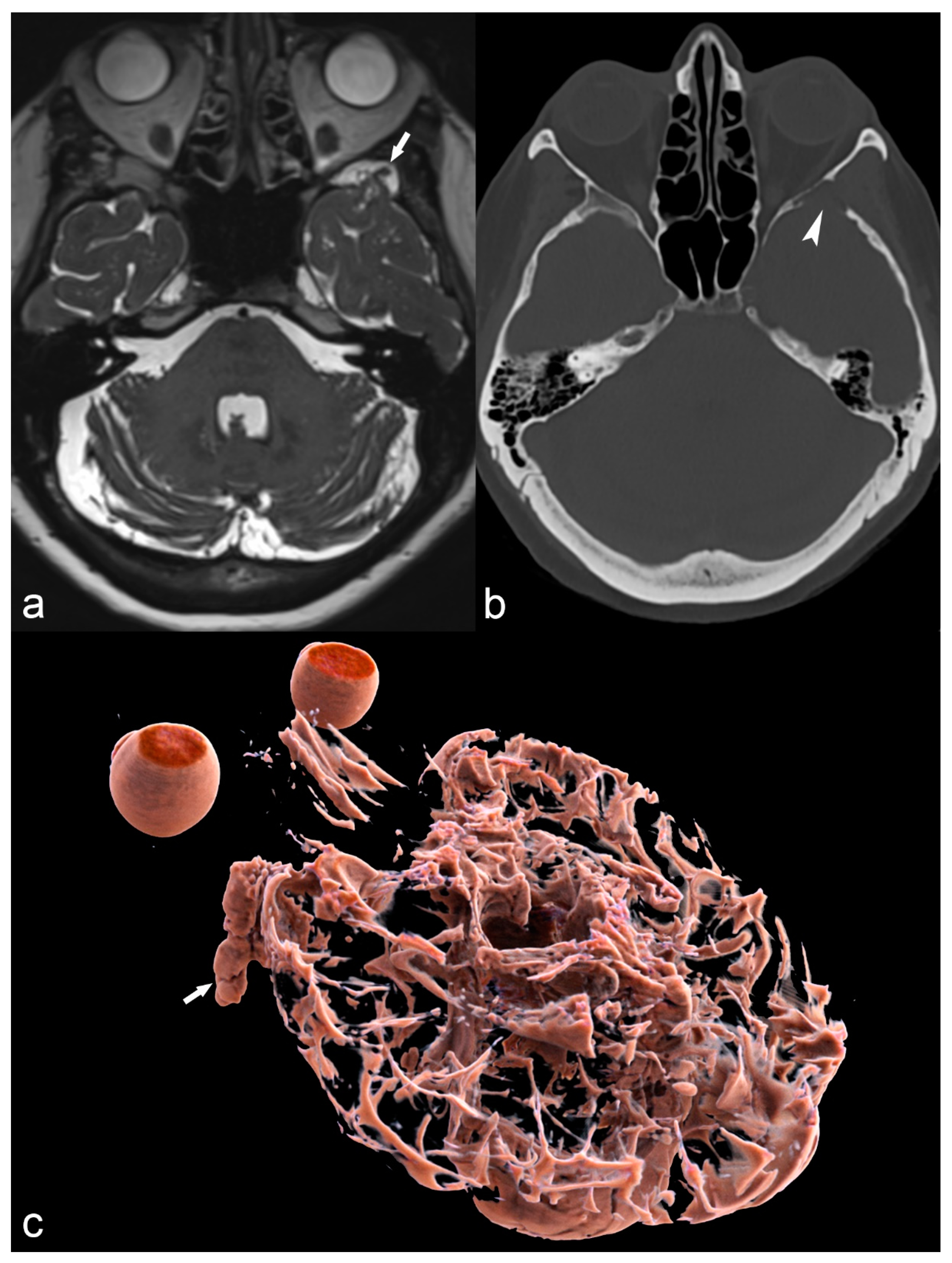 Children 06 00043 g014 Children 06 00043 g014