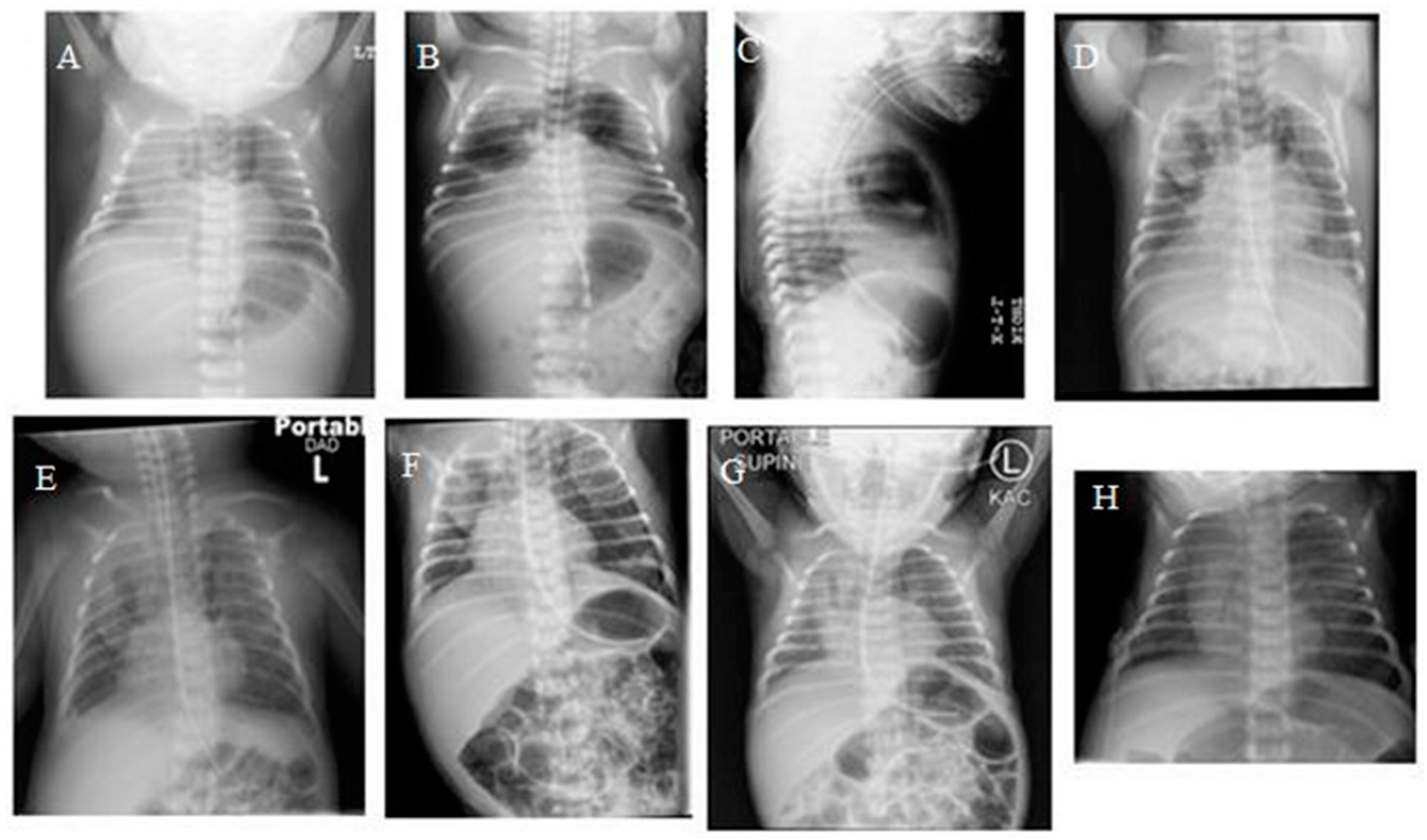 Children 06 00104 g001