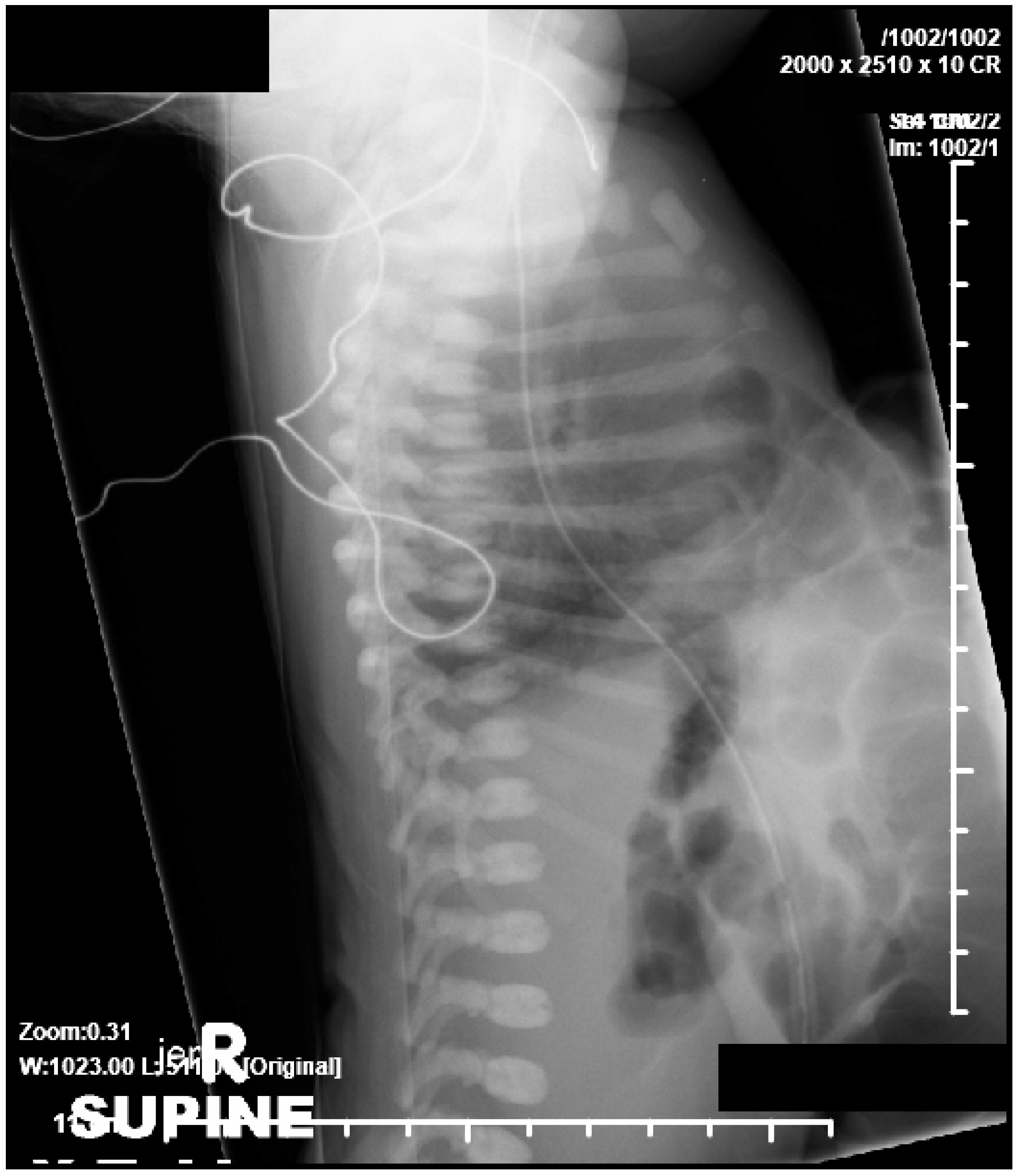 Children 06 00109 g002 Children 06 00109 g002