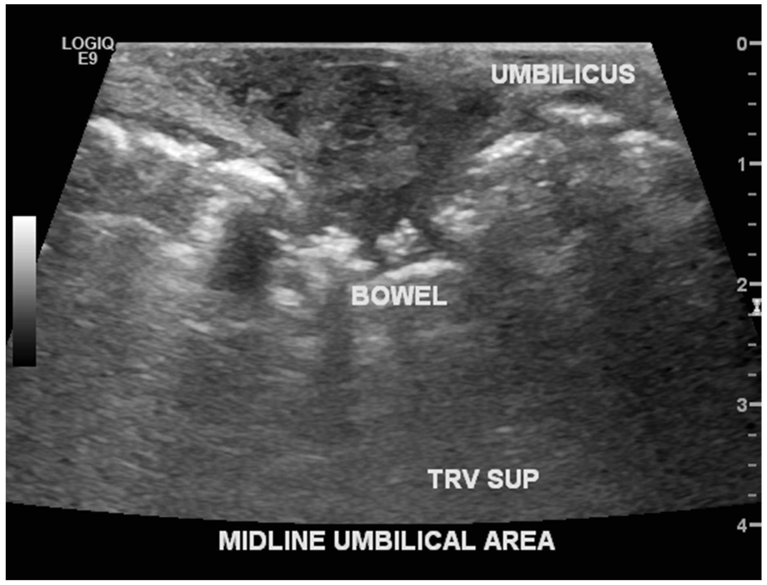 Children 06 00109 g005 Children 06 00109 g005