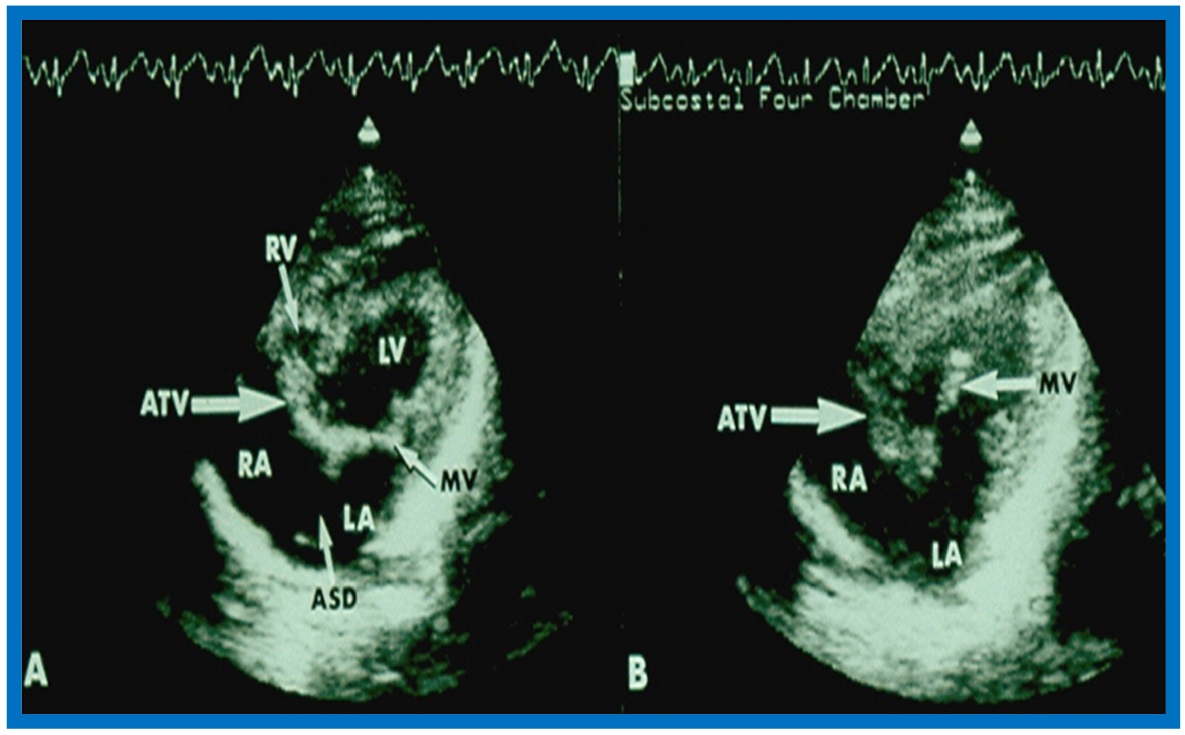 Children 07 00032 g015