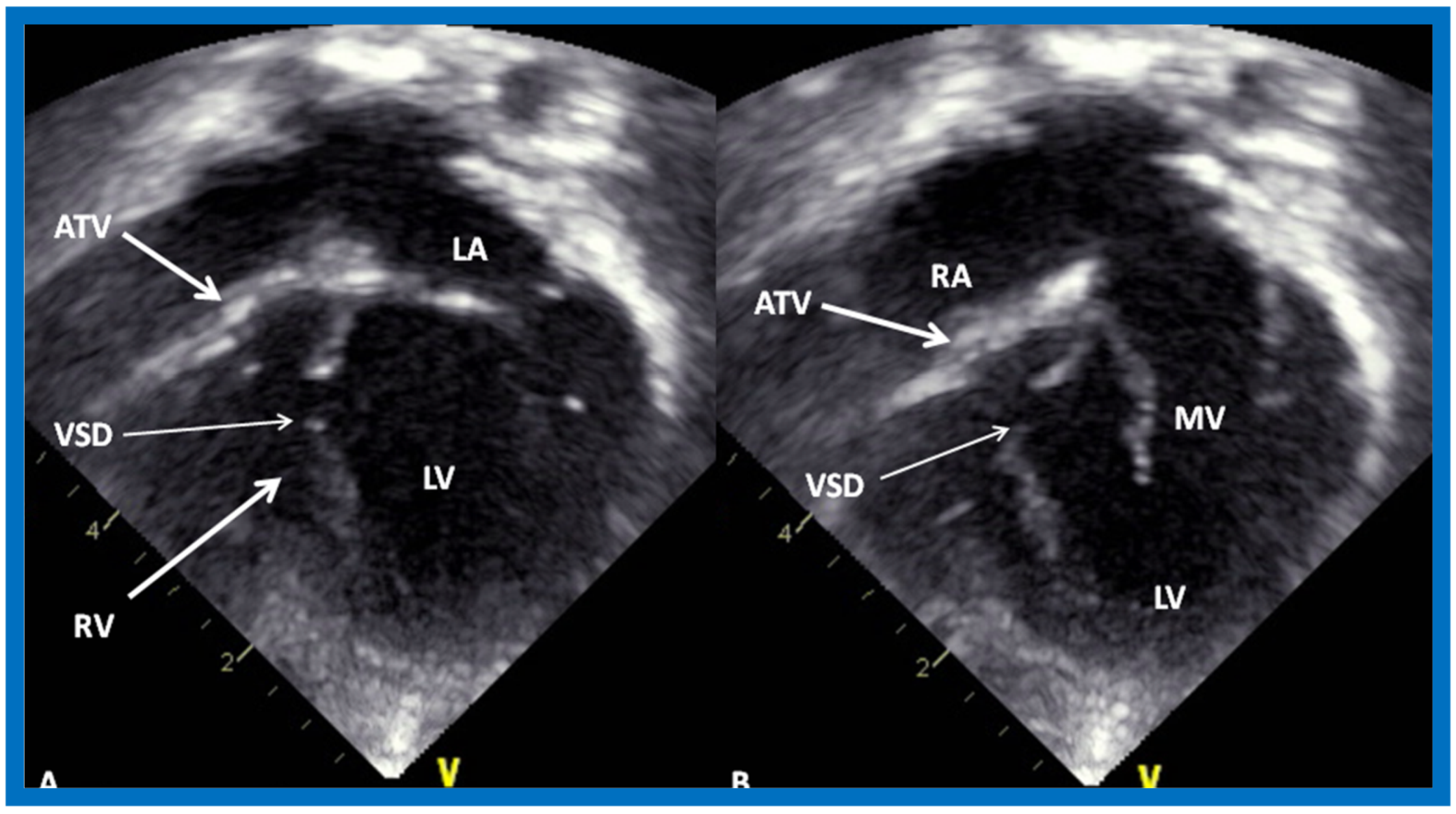 Children 07 00032 g017