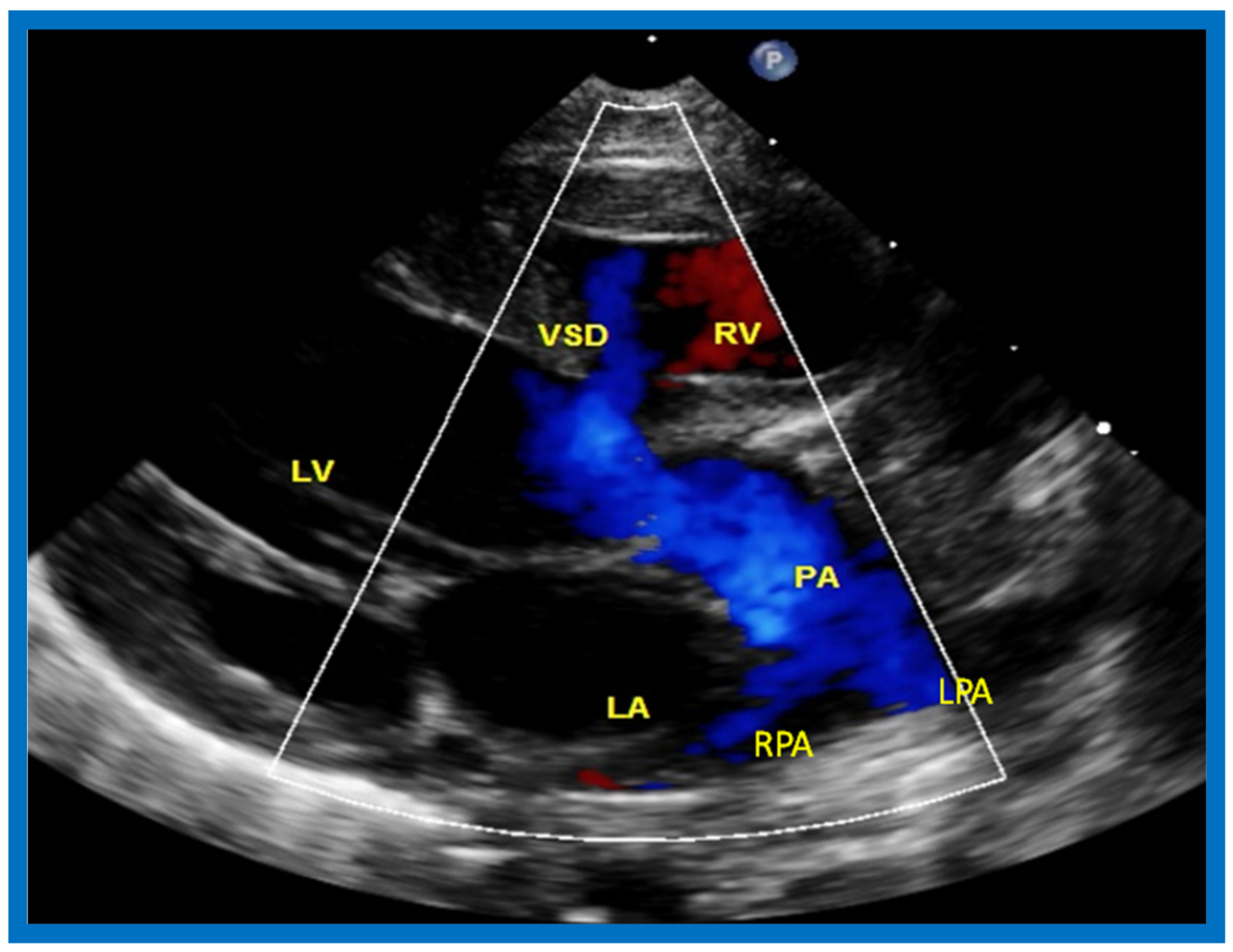 Children 07 00032 g022