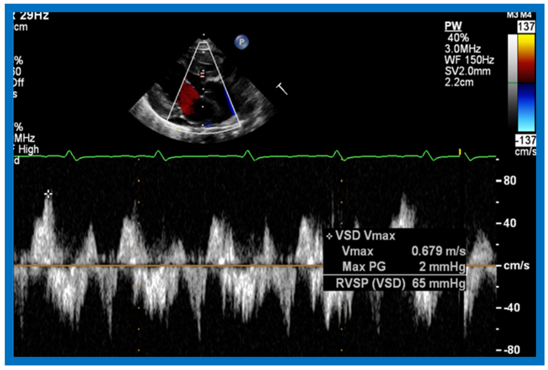 Children 07 00032 g025