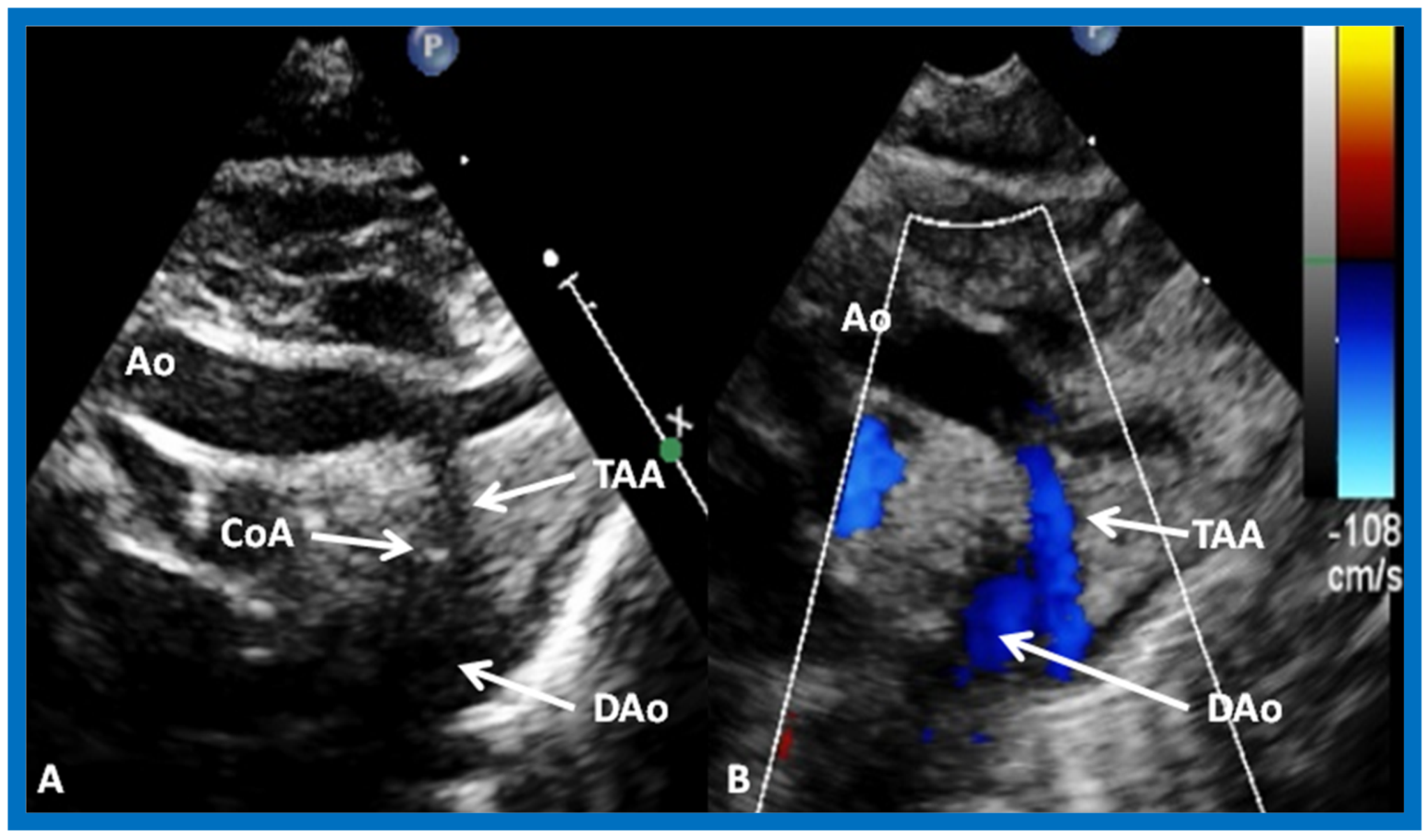 Children 07 00032 g026