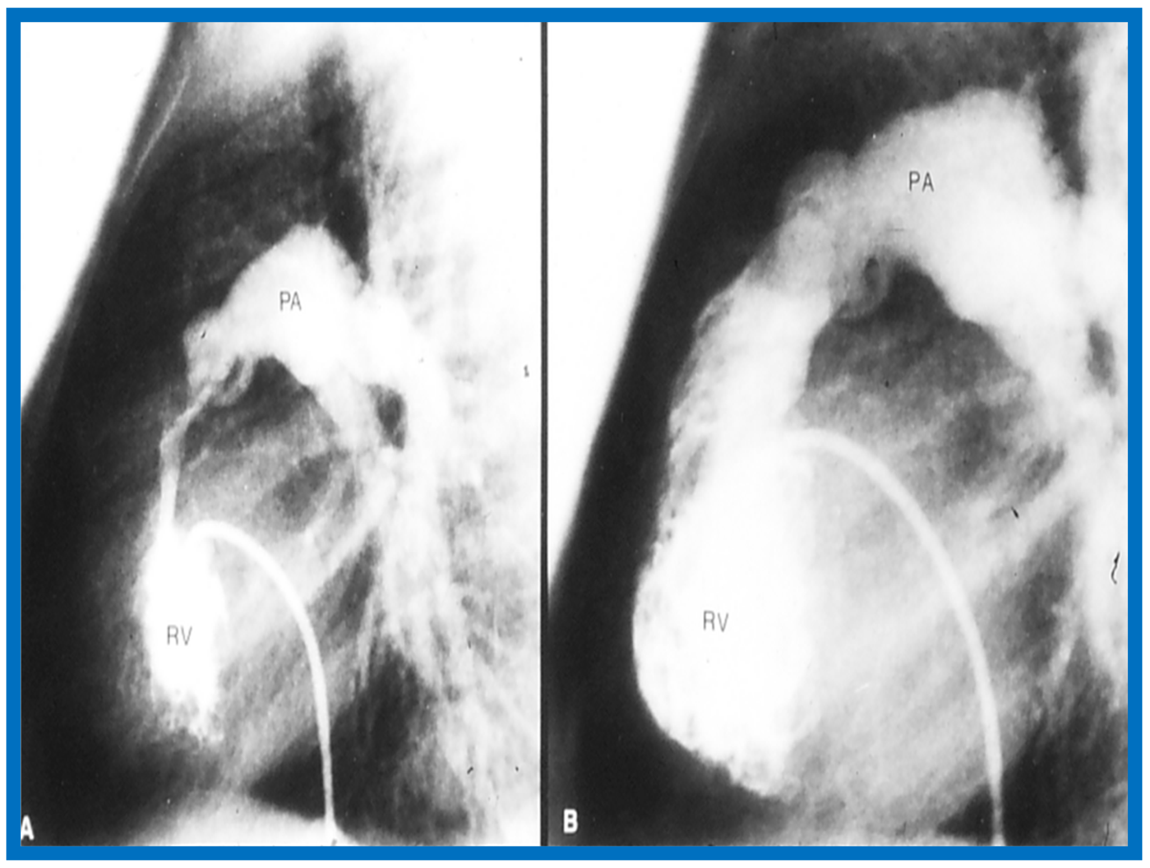 Children 07 00032 g048