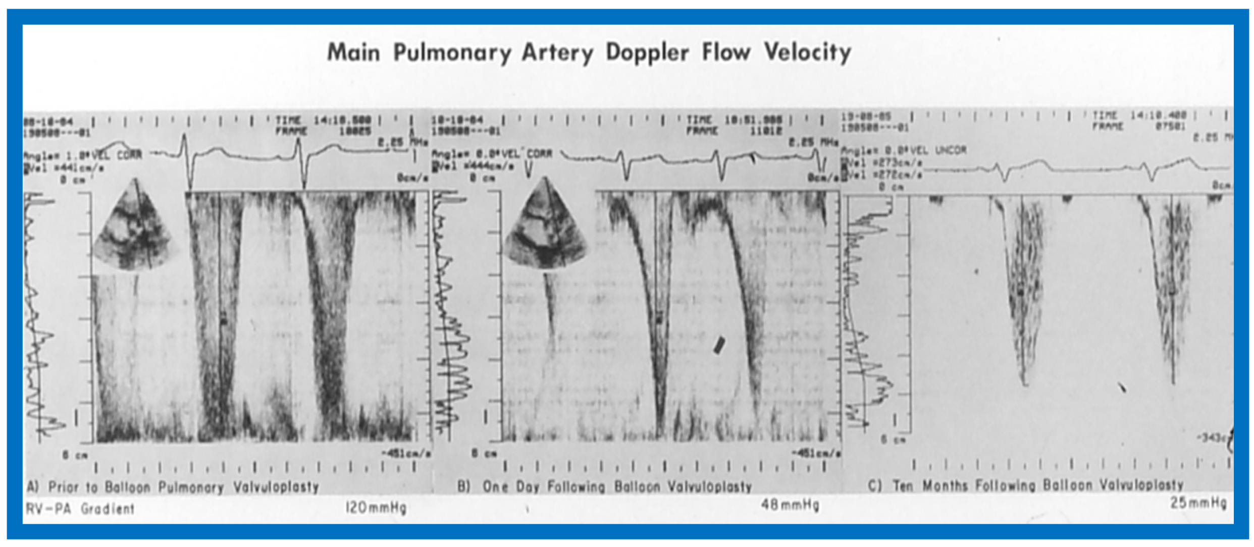 Children 07 00032 g049