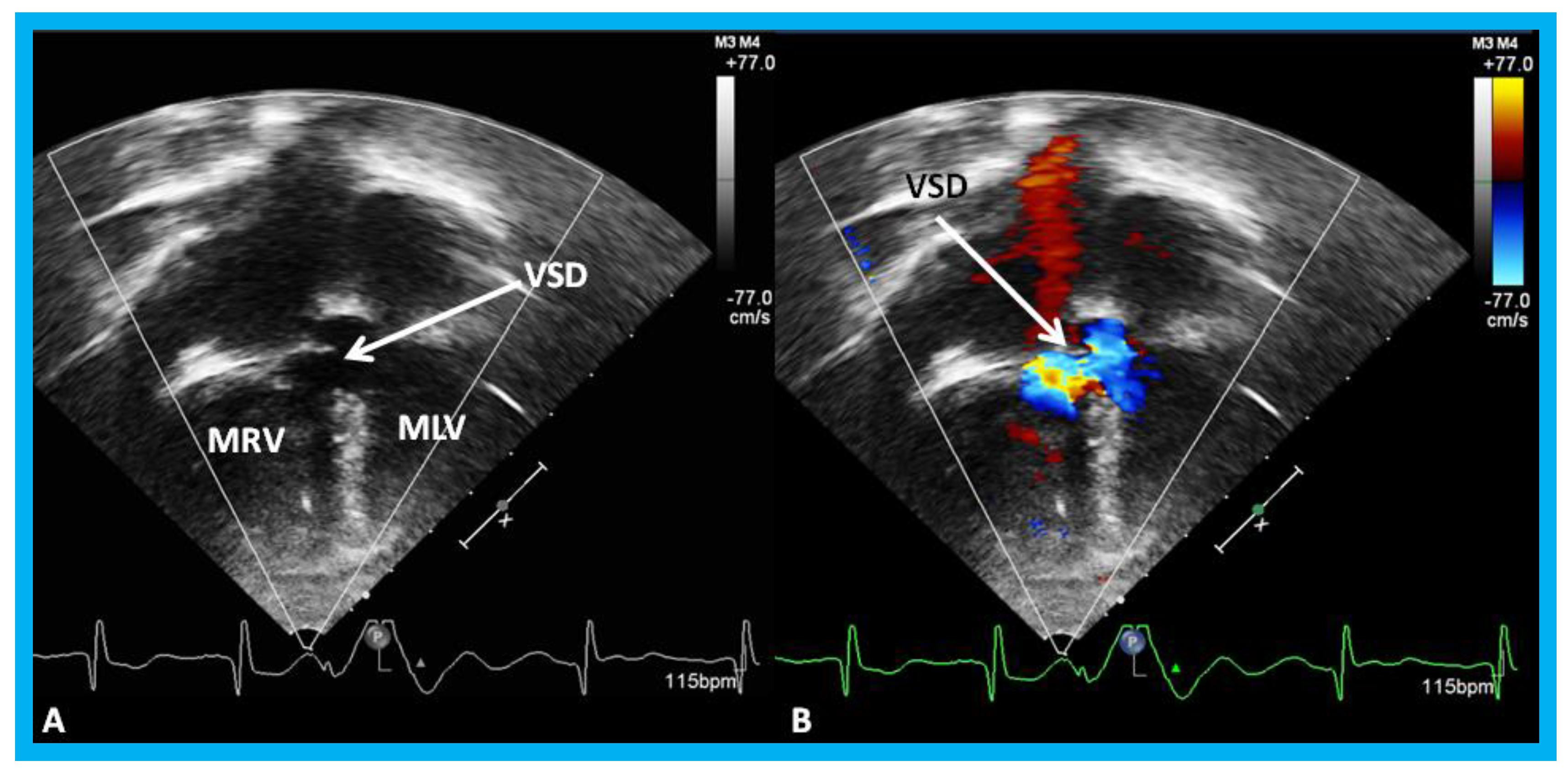 Children 07 00034 g018