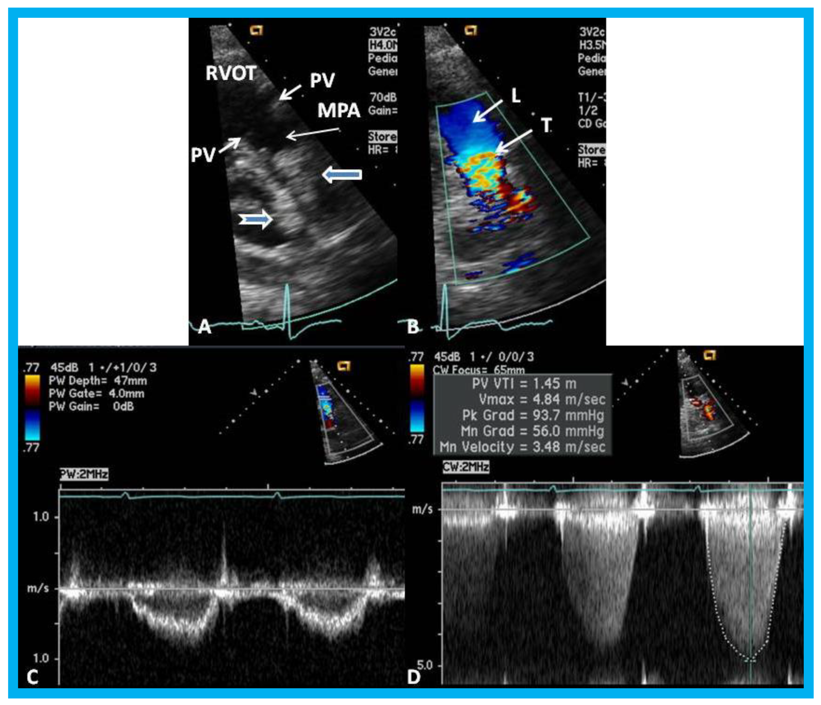 Children 07 00034 g021