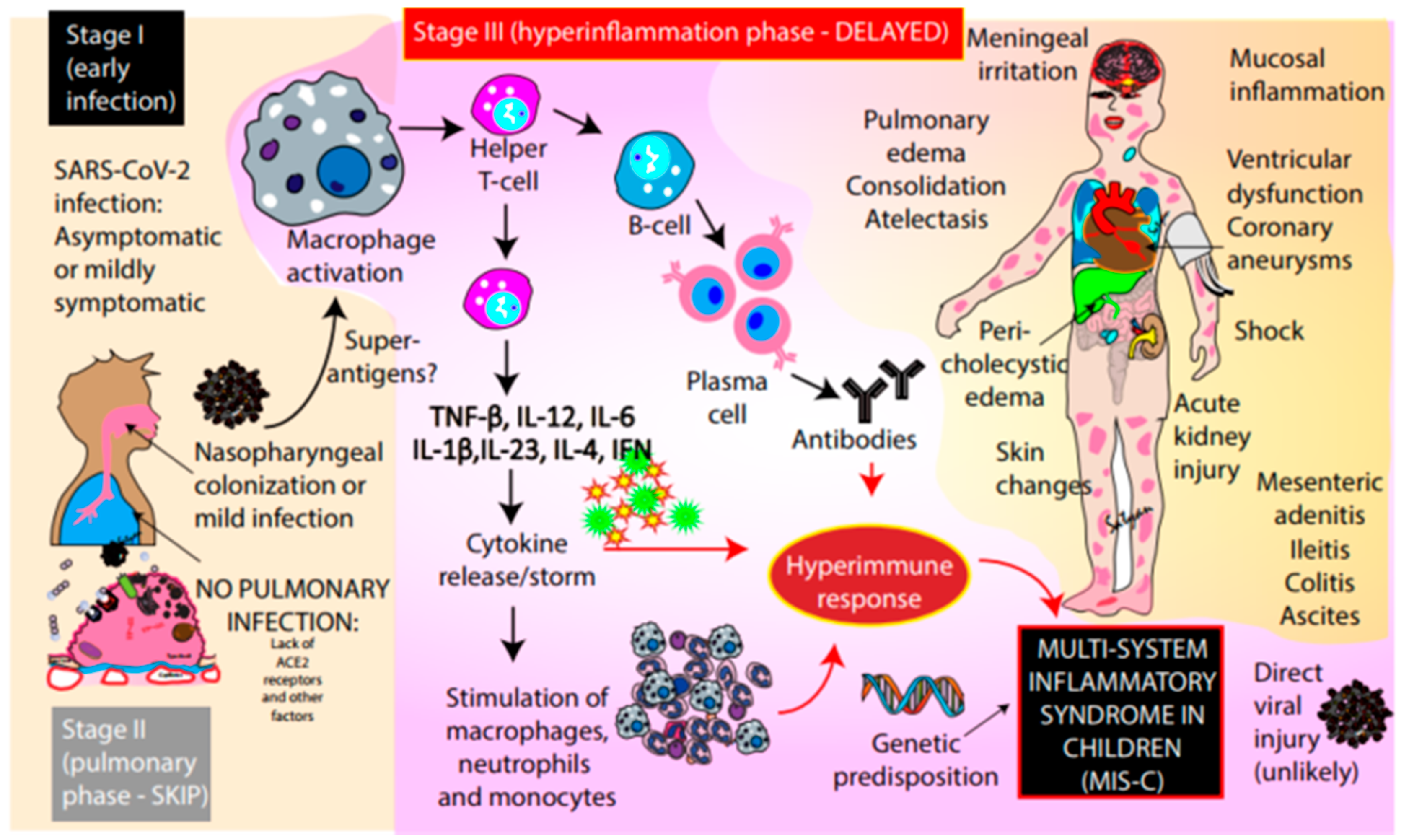 Children Free Full Text Multi System Inflammatory Syndrome In Children Mis C Following Sars Cov 2 Infection Review Of Clinical Presentation Hypothetical Pathogenesis And Proposed Management Html