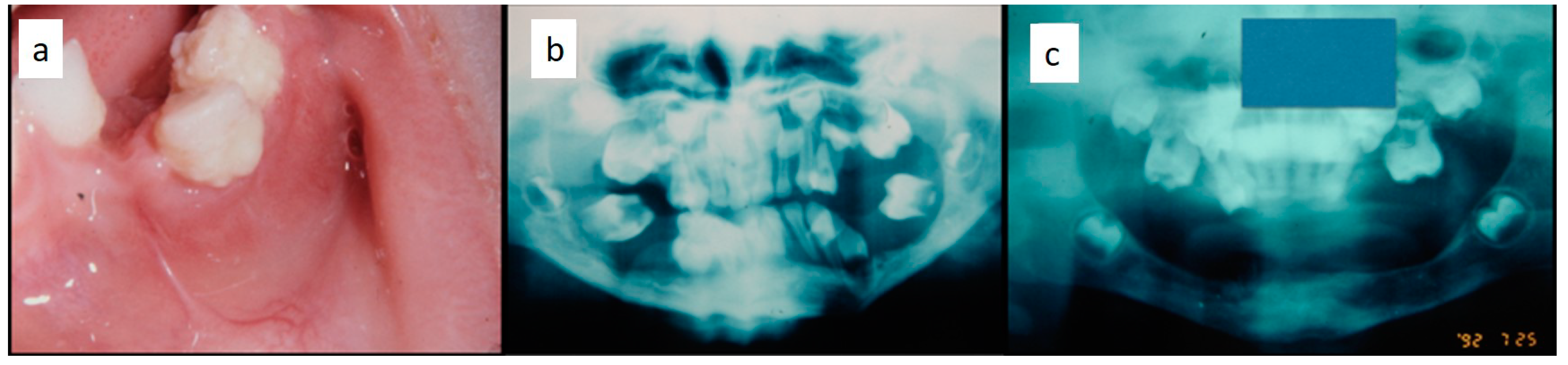 Children 07 00104 g005