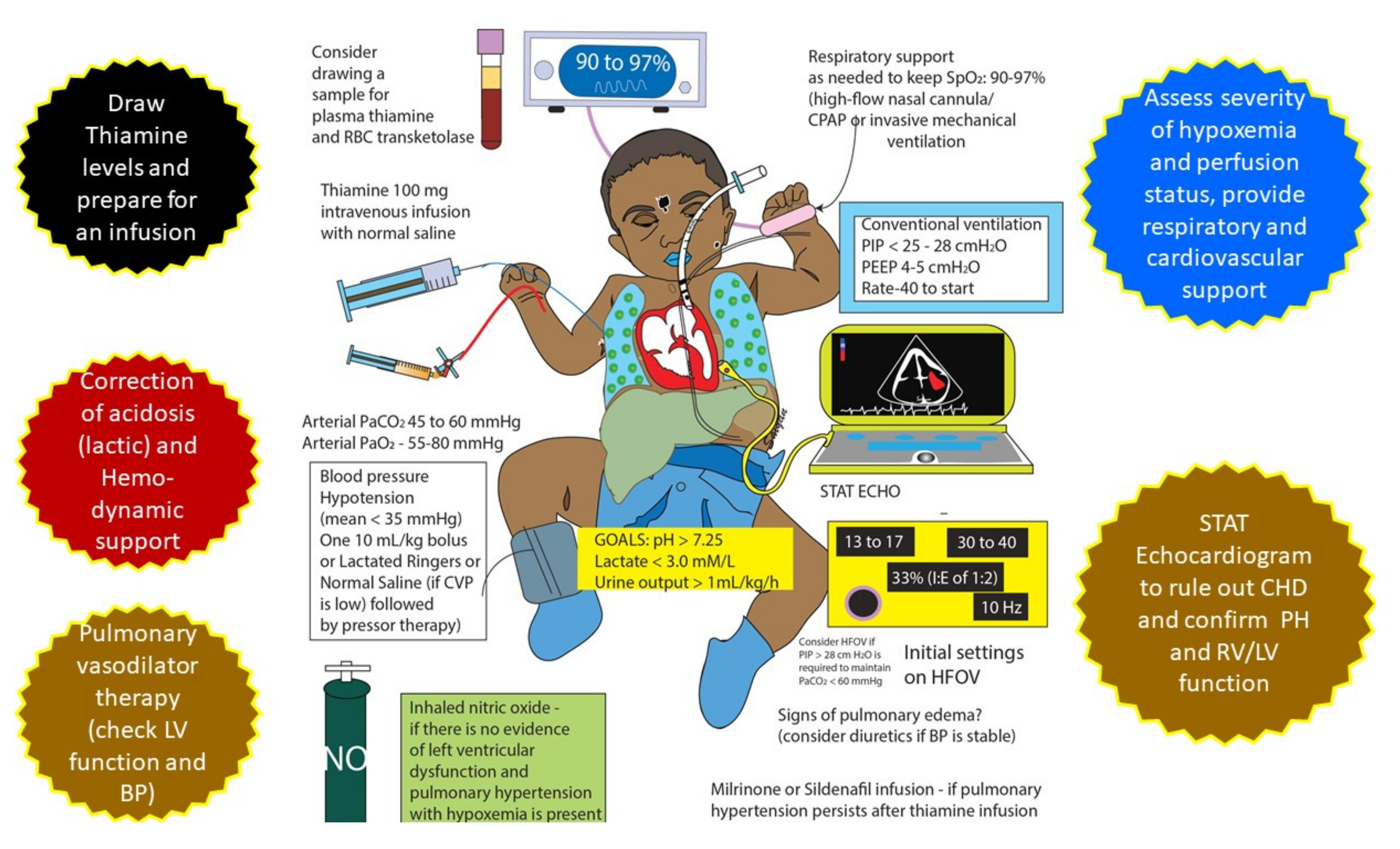 Children Free Full Text Thiamine Responsive Acute Pulmonary Hypertension Of Early Infancy Traphei A Case Series And Clinical Review