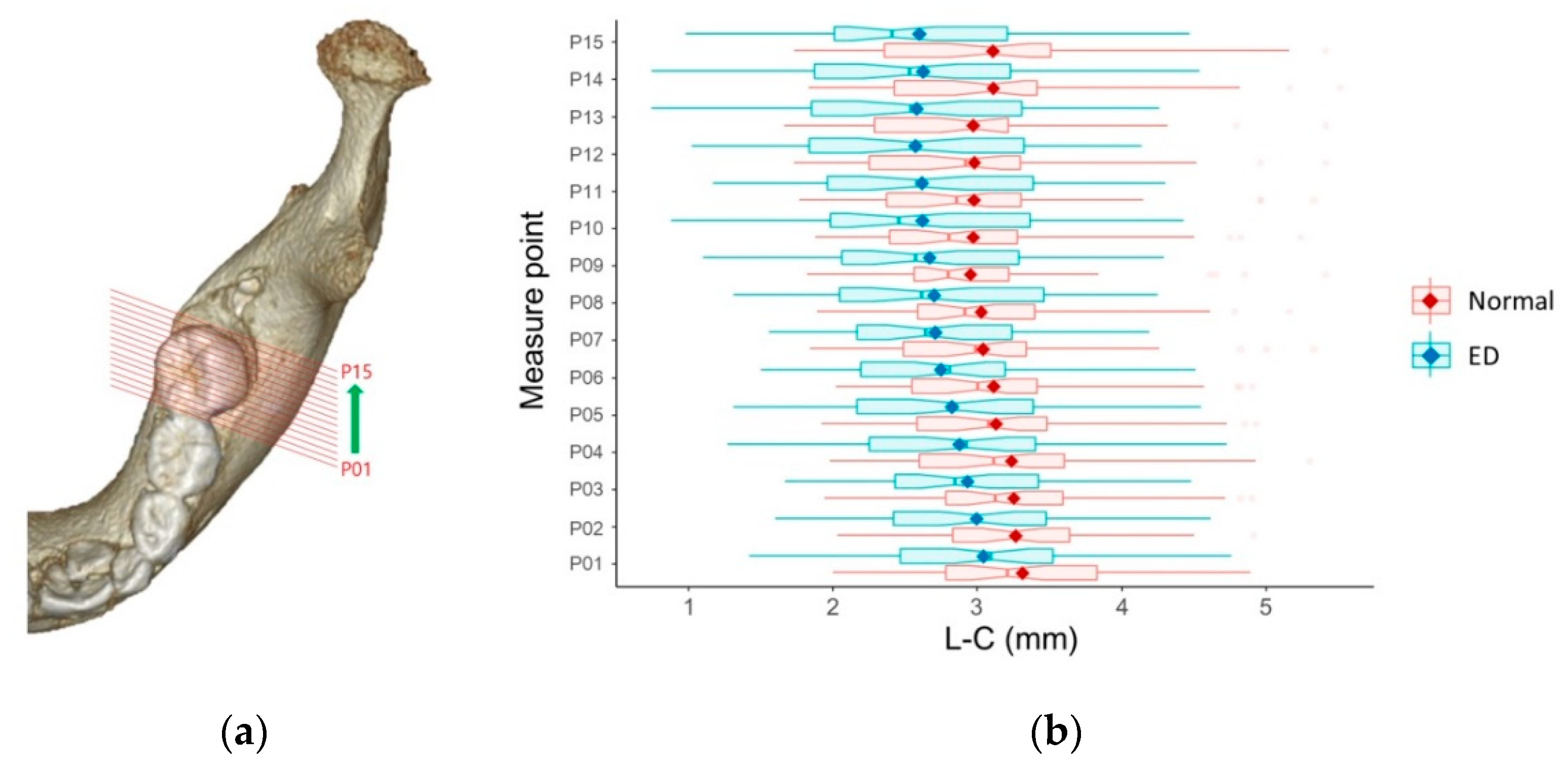Children 07 00206 g005