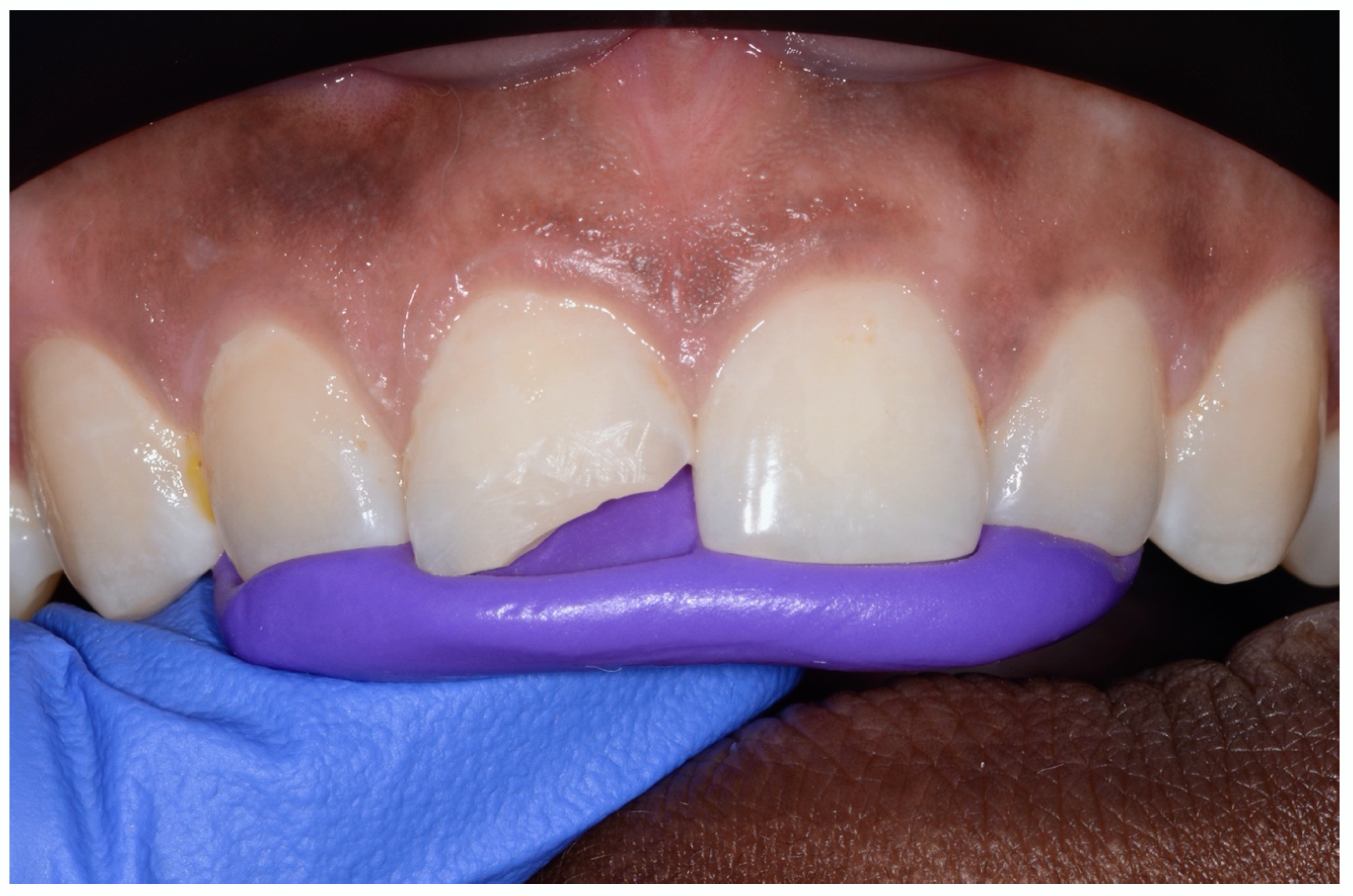 Children 07 00237 g004 Children 07 00237 g004