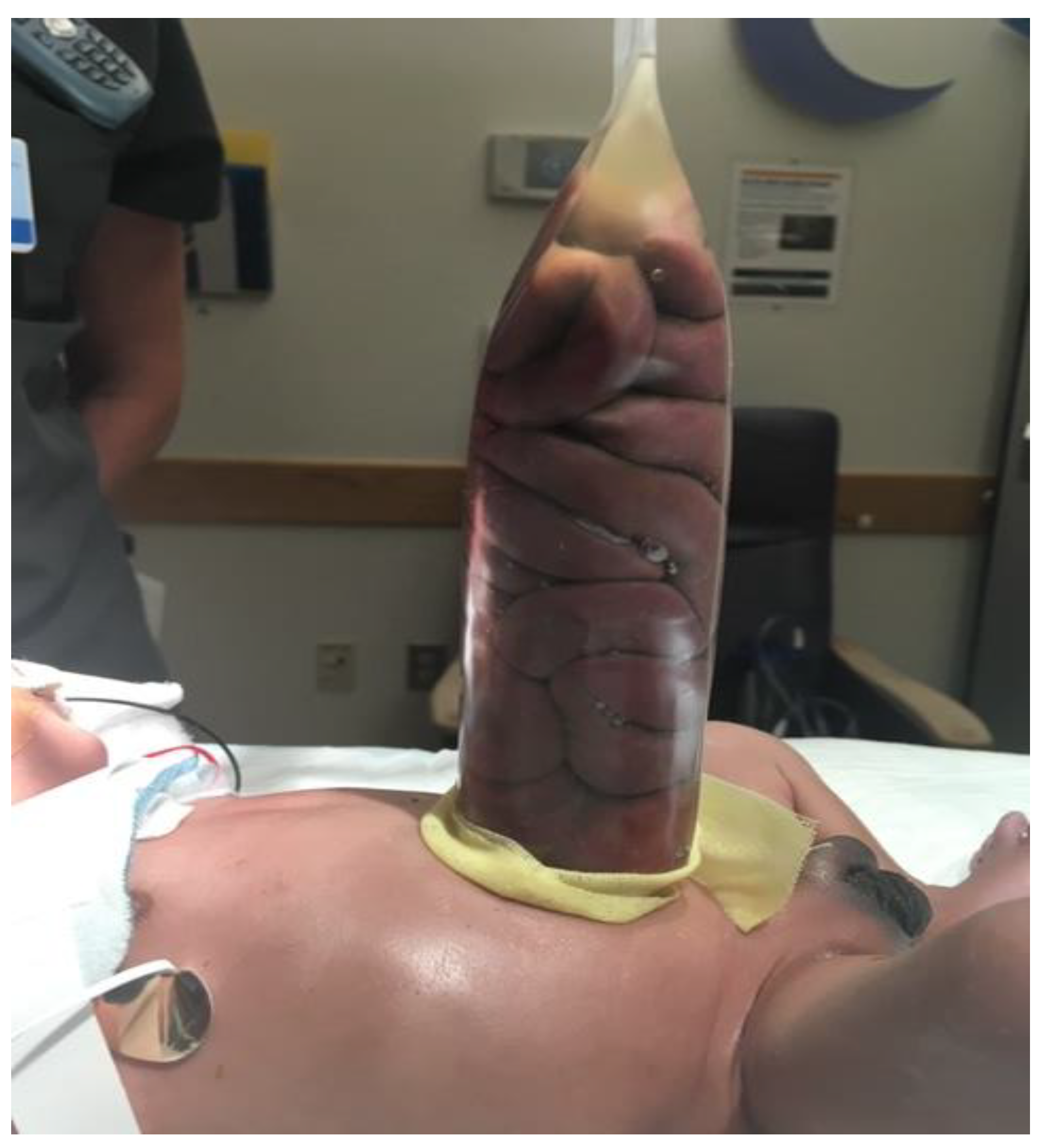 Children 07 00302 g002 Children 07 00302 g002