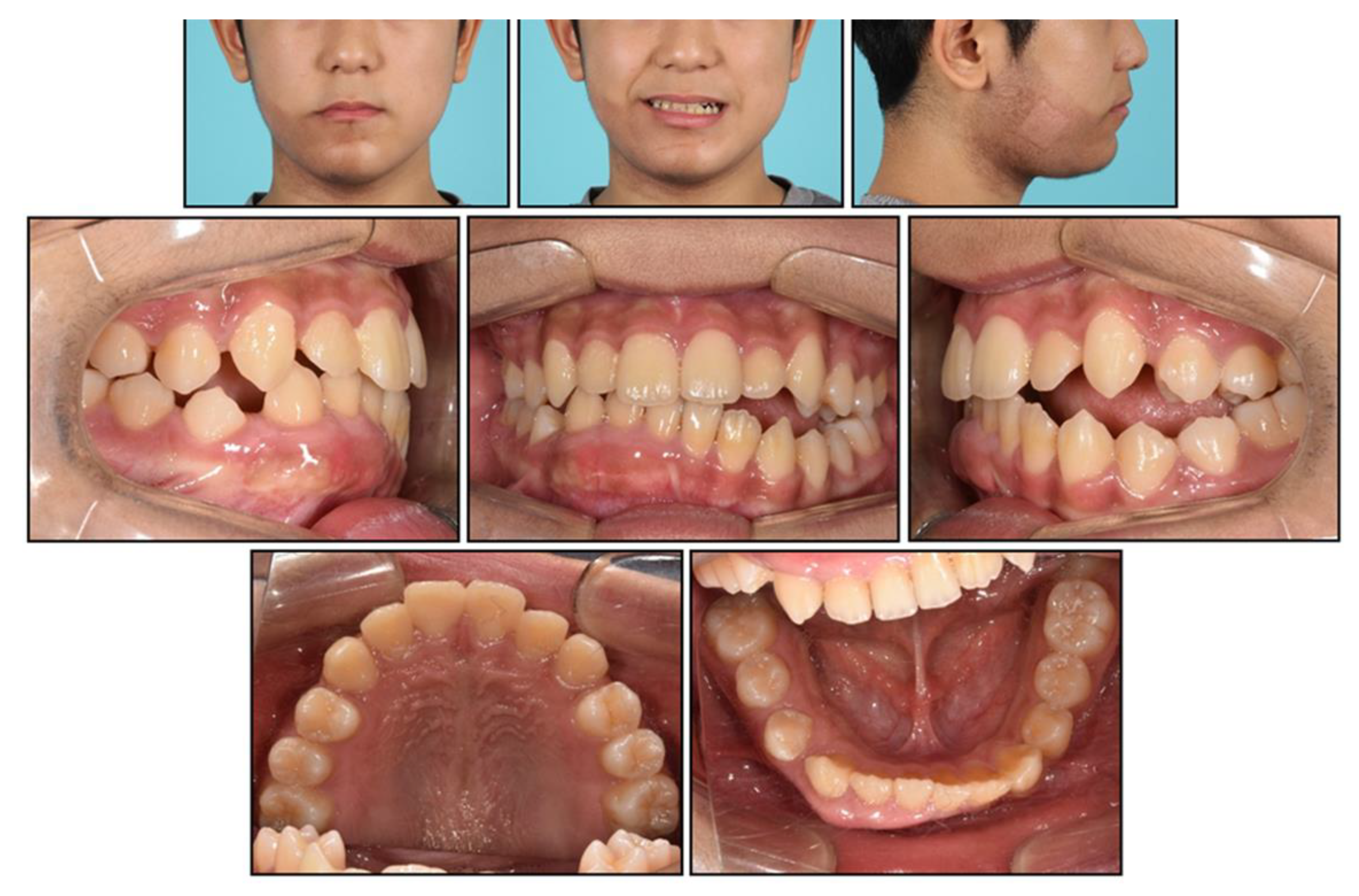 Children 08 00072 g007