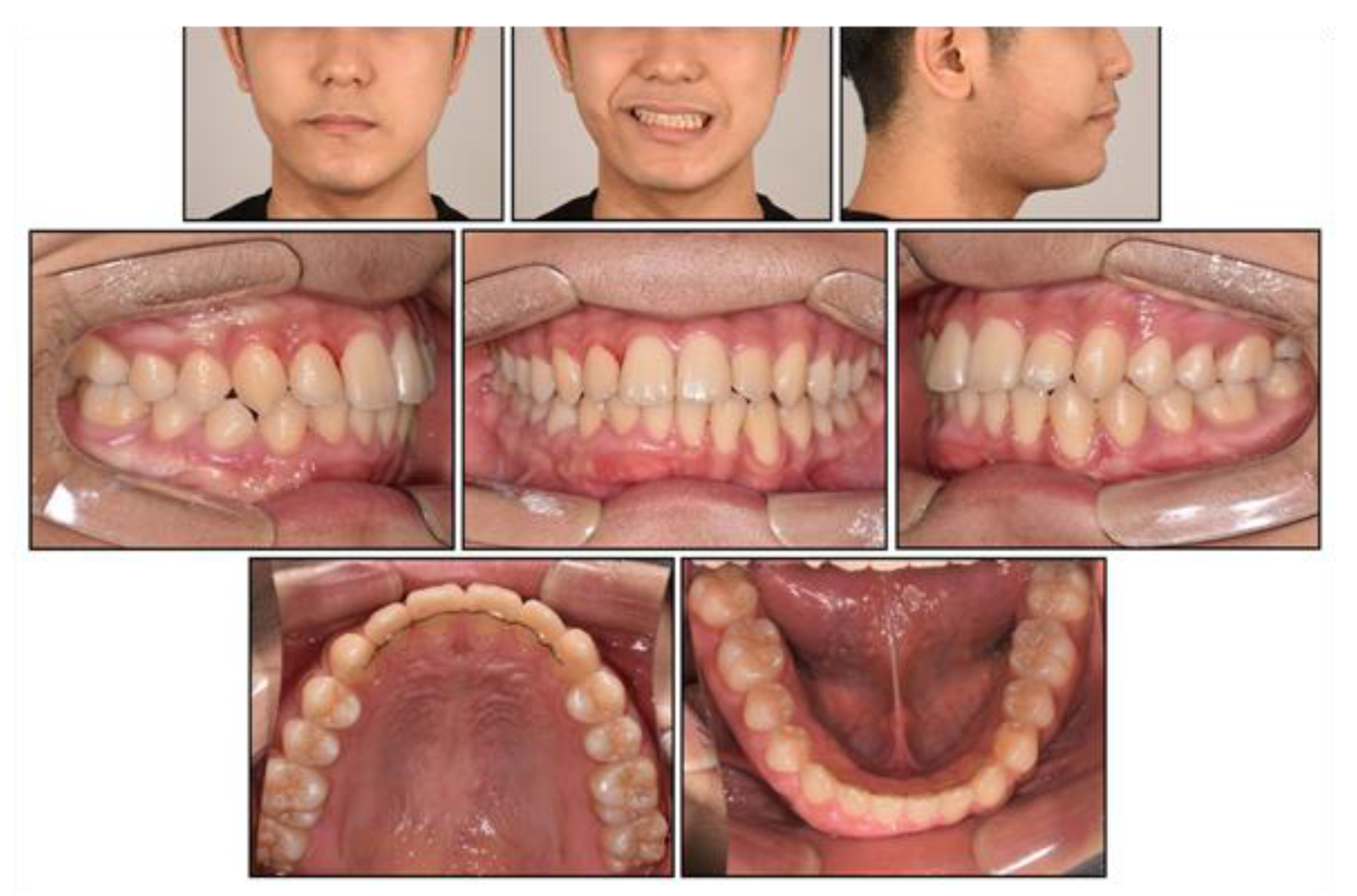 Children 08 00072 g013