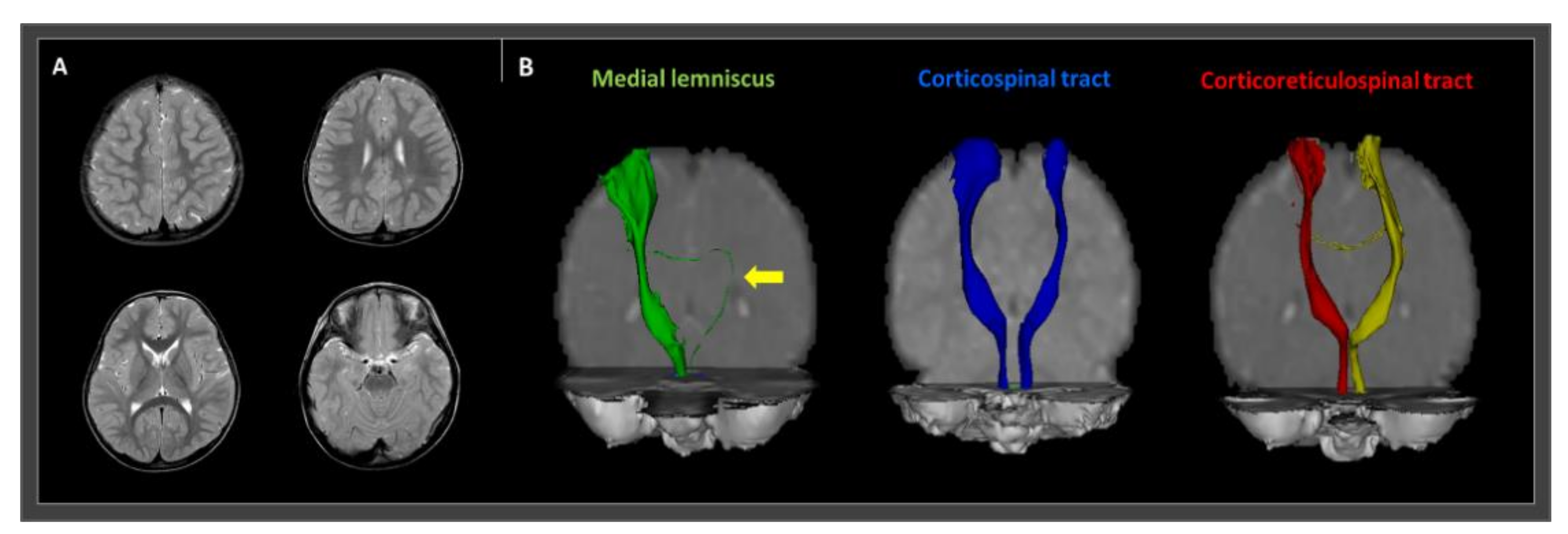 Children 08 00081 g001