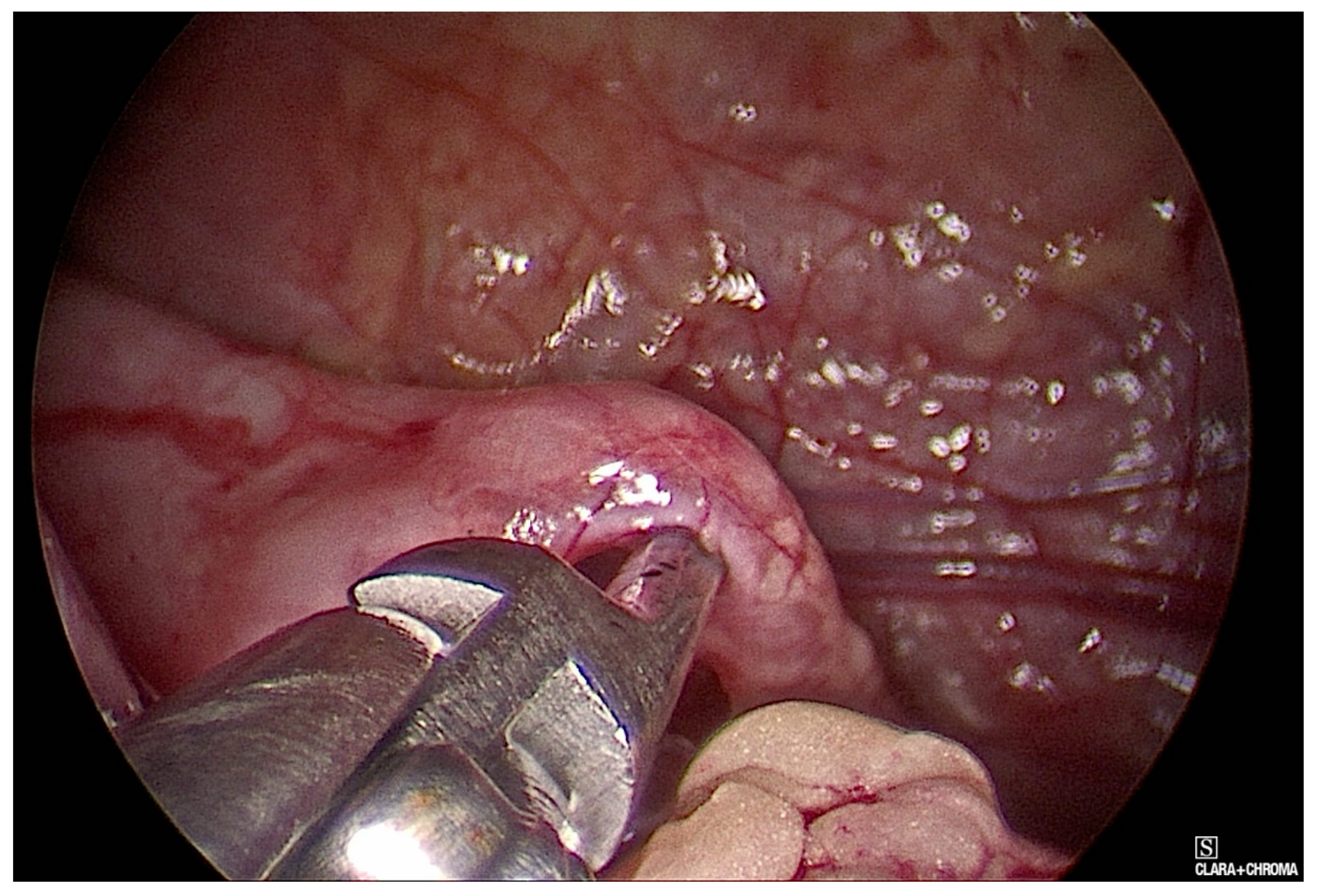 Children 08 00107 g002