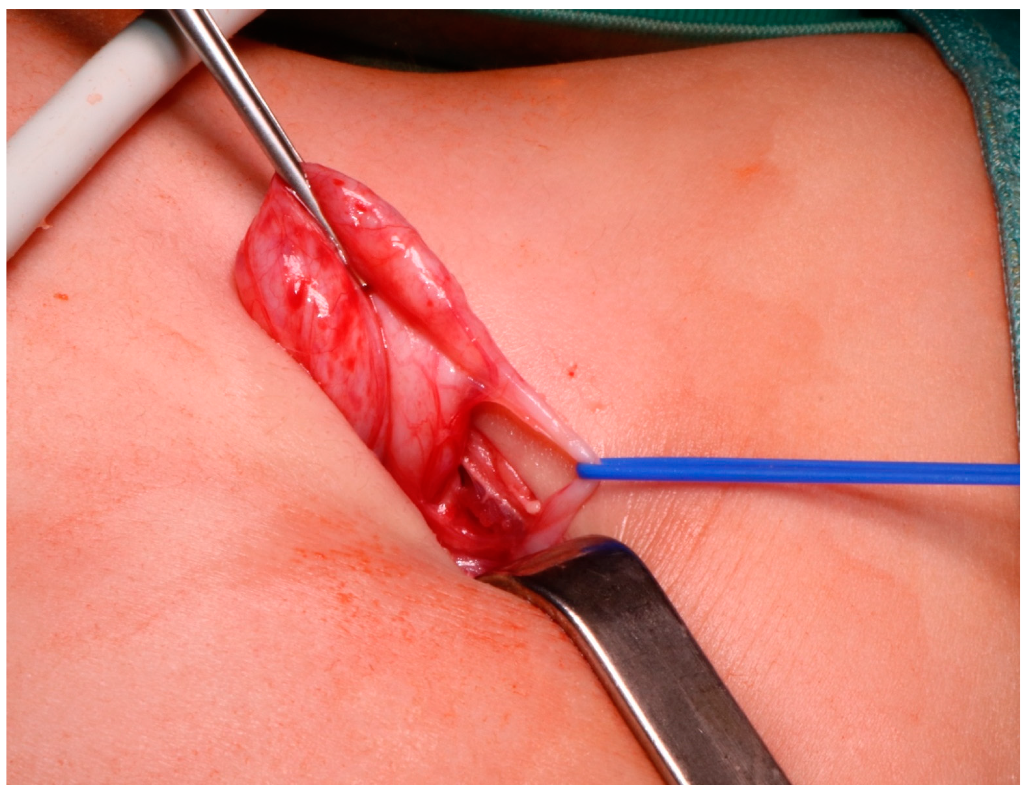 Children 08 00107 g003