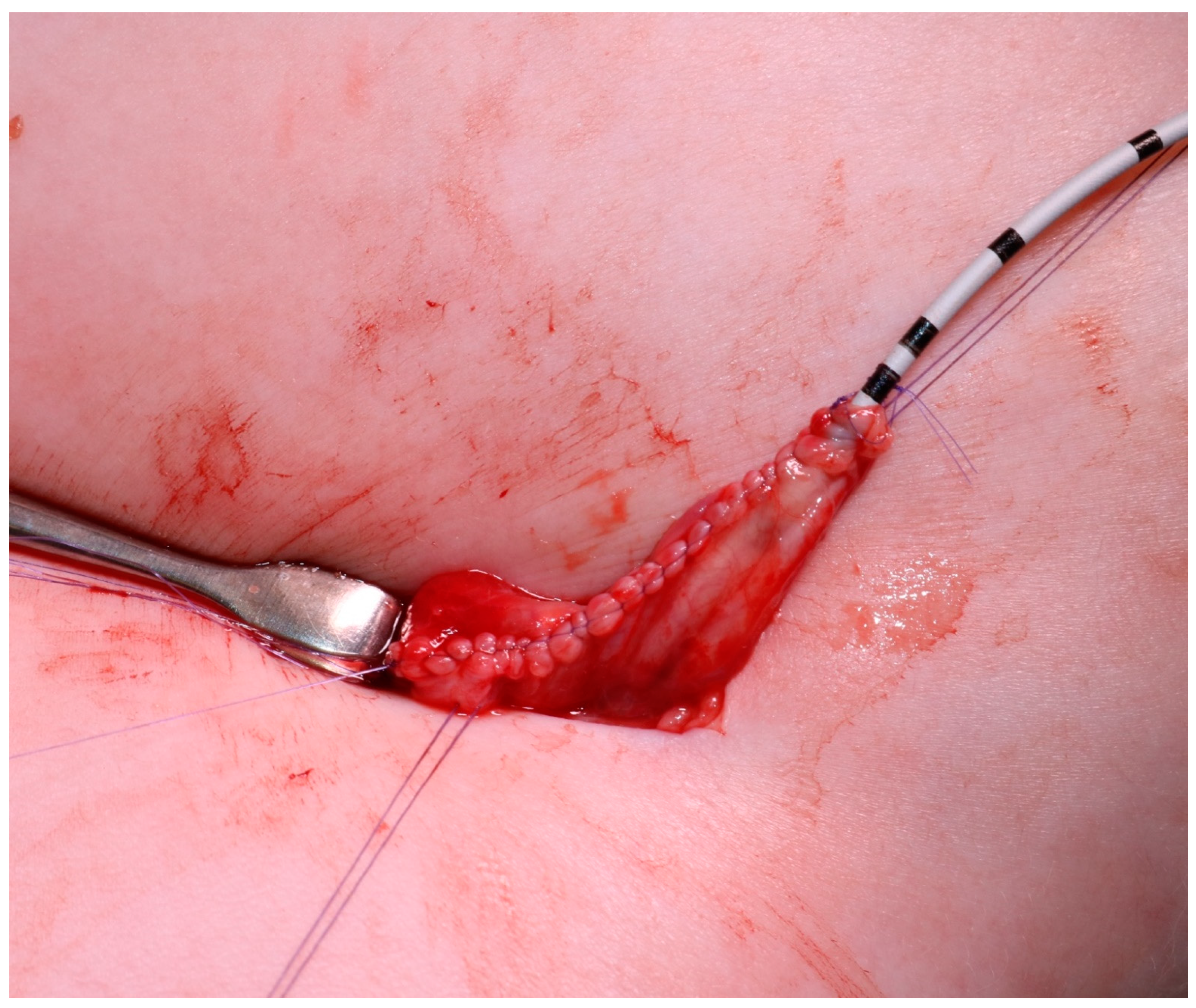 Children 08 00107 g005