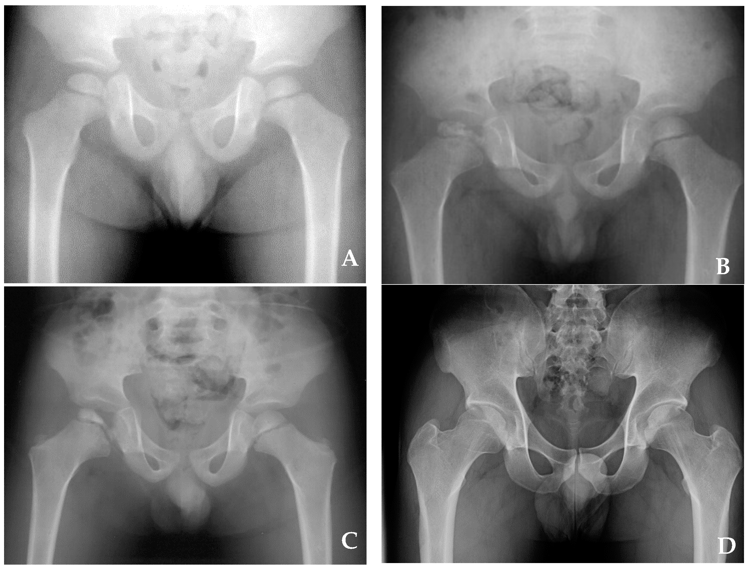 Children 08 00118 g001