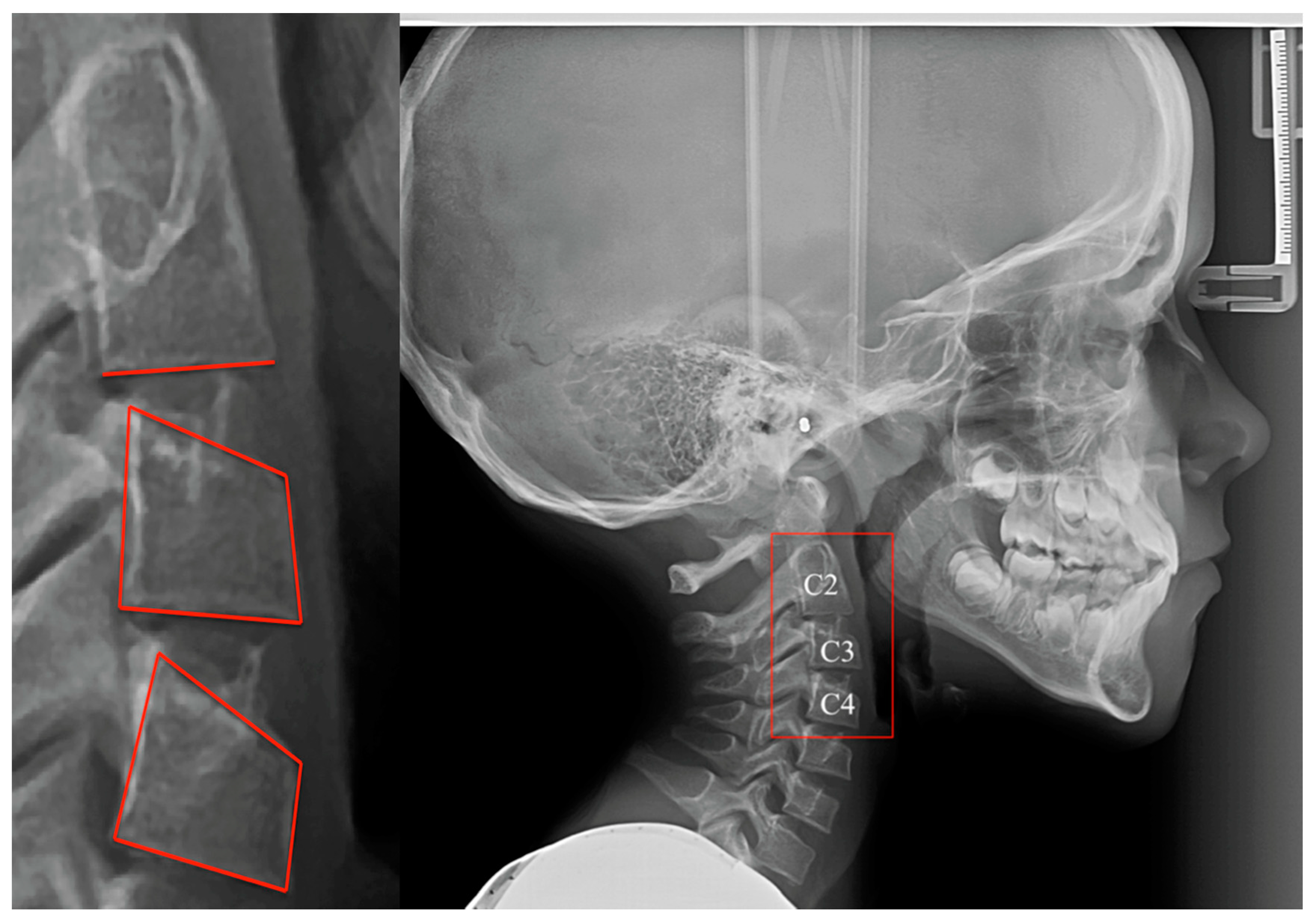 Children 08 00142 g001